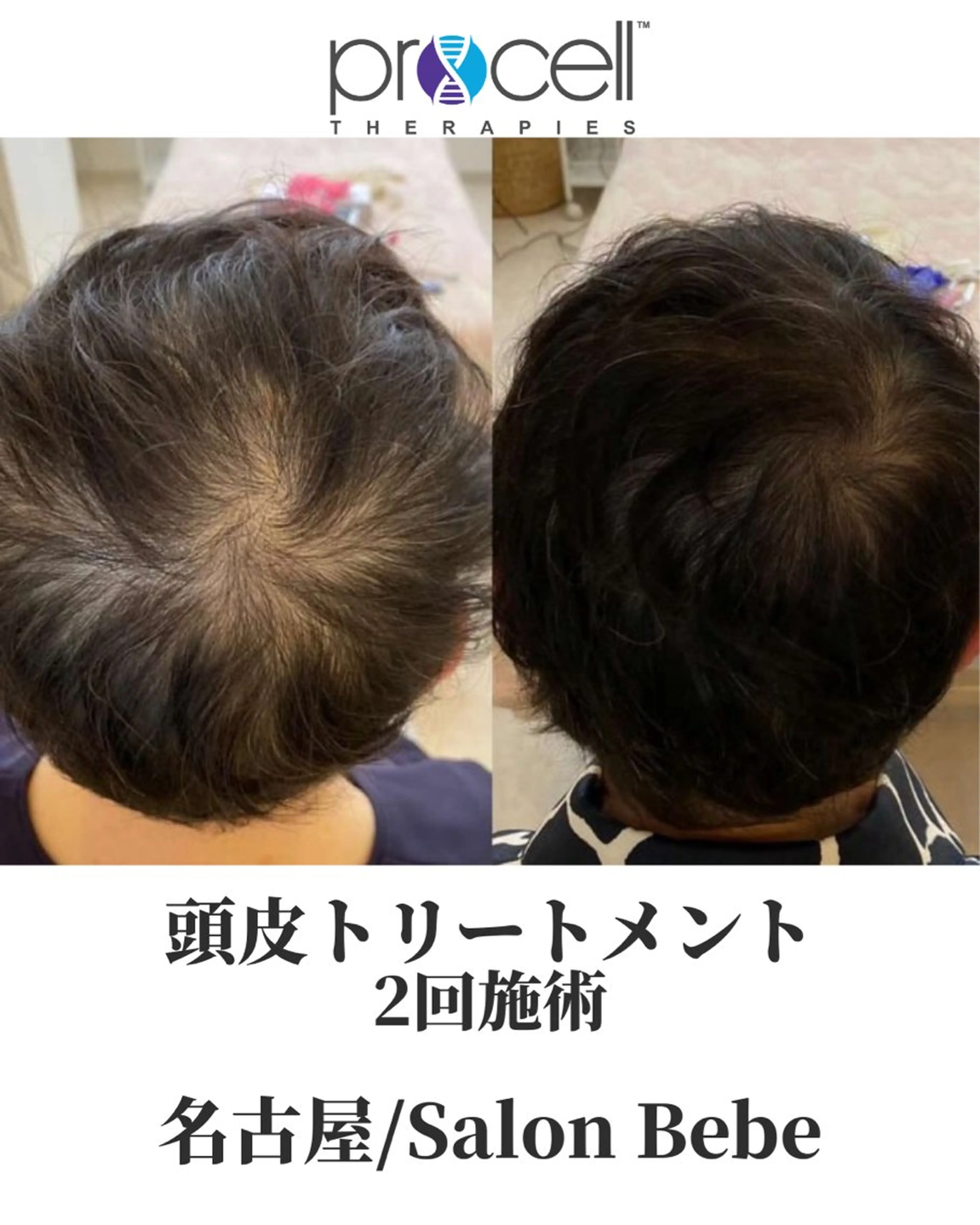 エステ Salon Bebe 名古屋のエステ・リラクイメージ