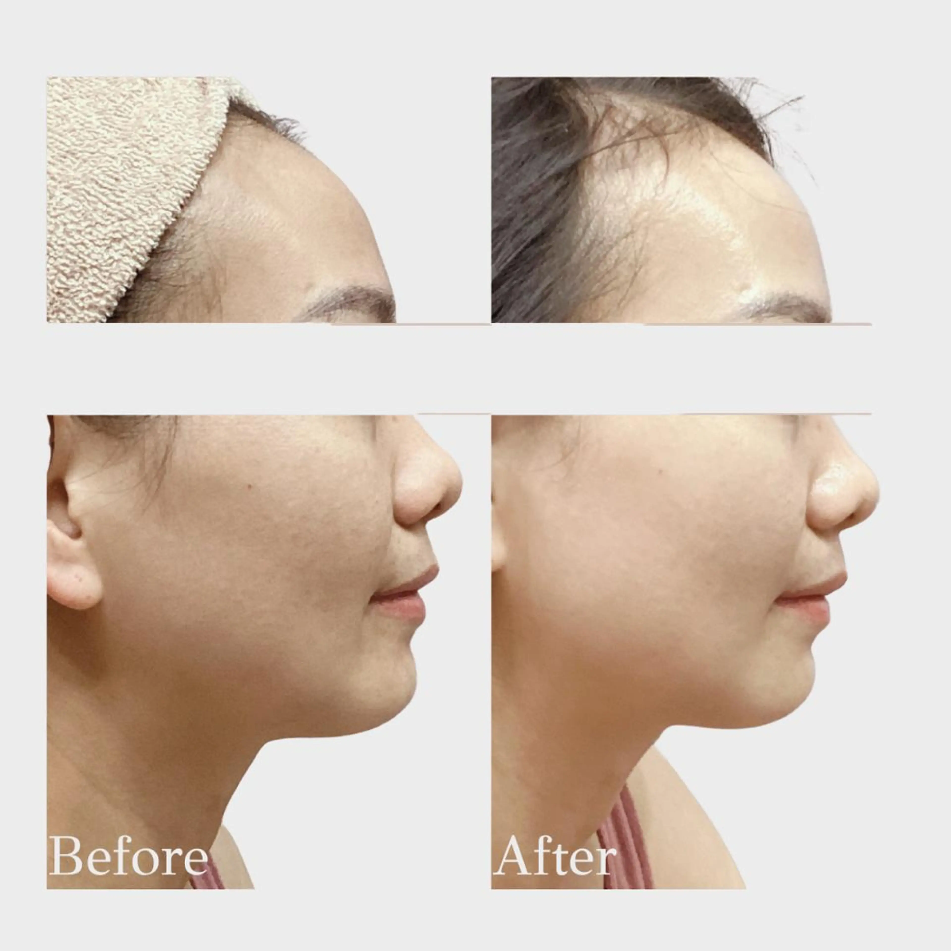 エステ リラク 看護師 AYUIのエステ・リラクイメージ