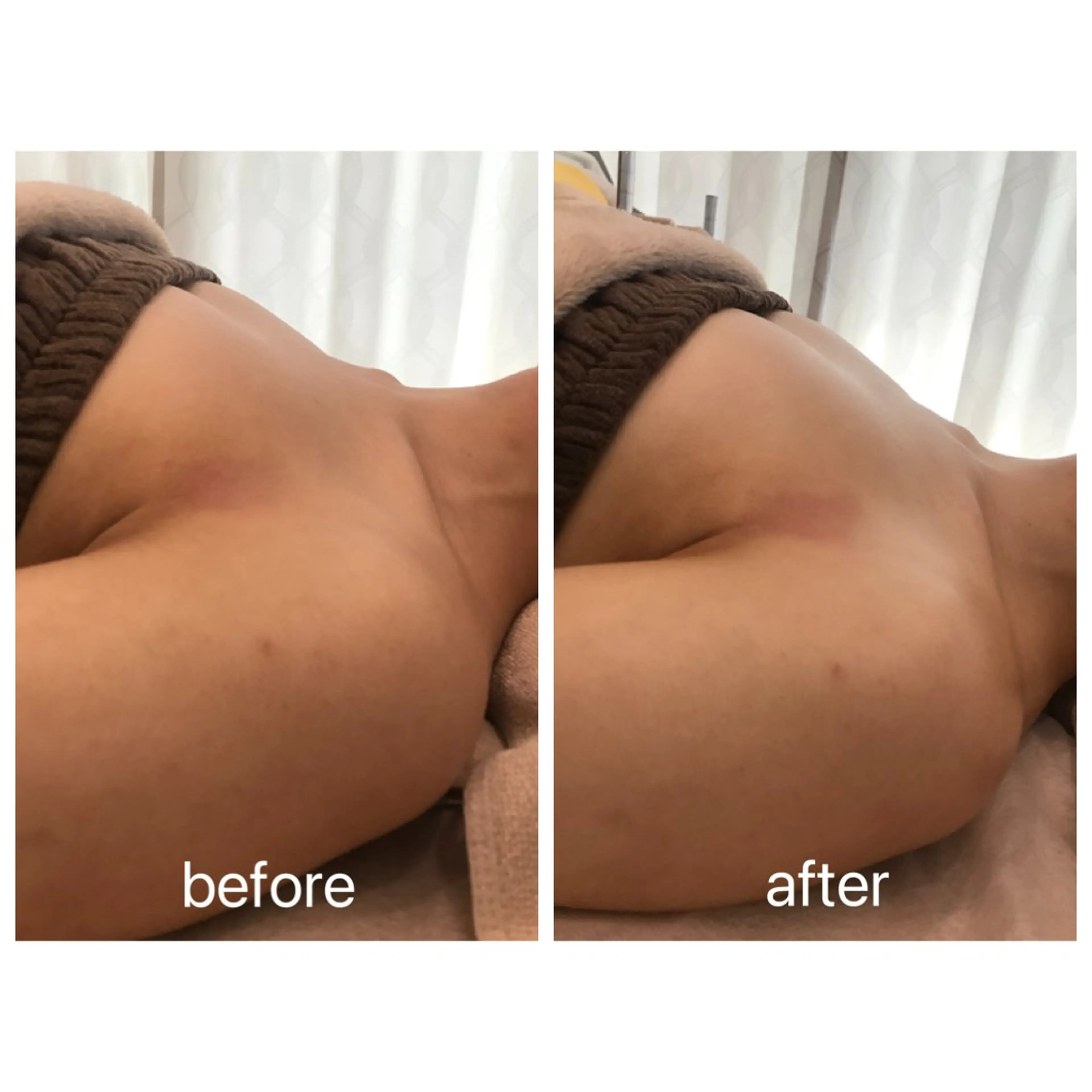 Rene 慢性疲労ケアサロンのエステ・リラクイメージ