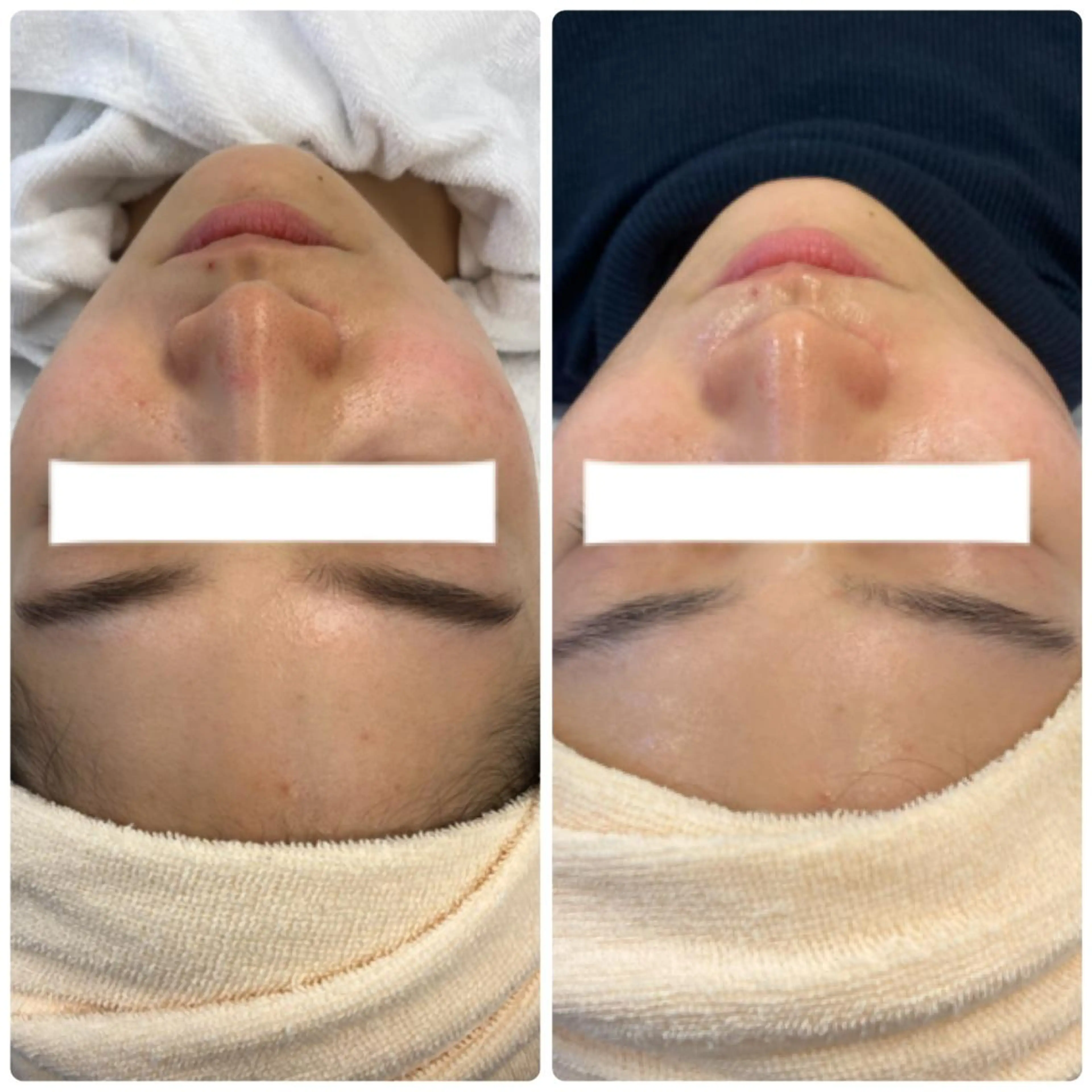 エステ リラク 肌質改善美容サロン ému 用賀のエステ・リラクイメージ