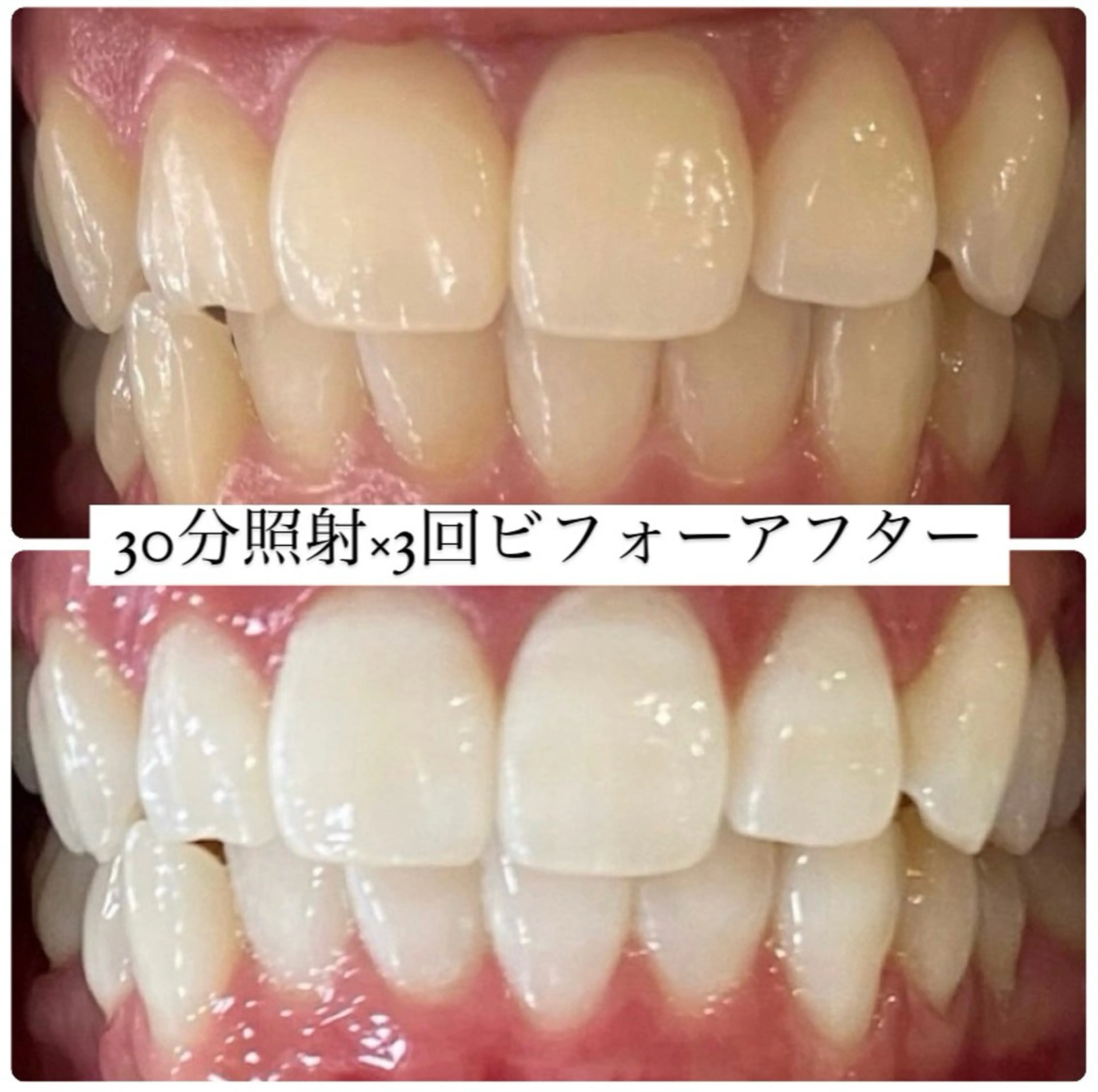 ホワイトニングルーム 横浜店のその他イメージ