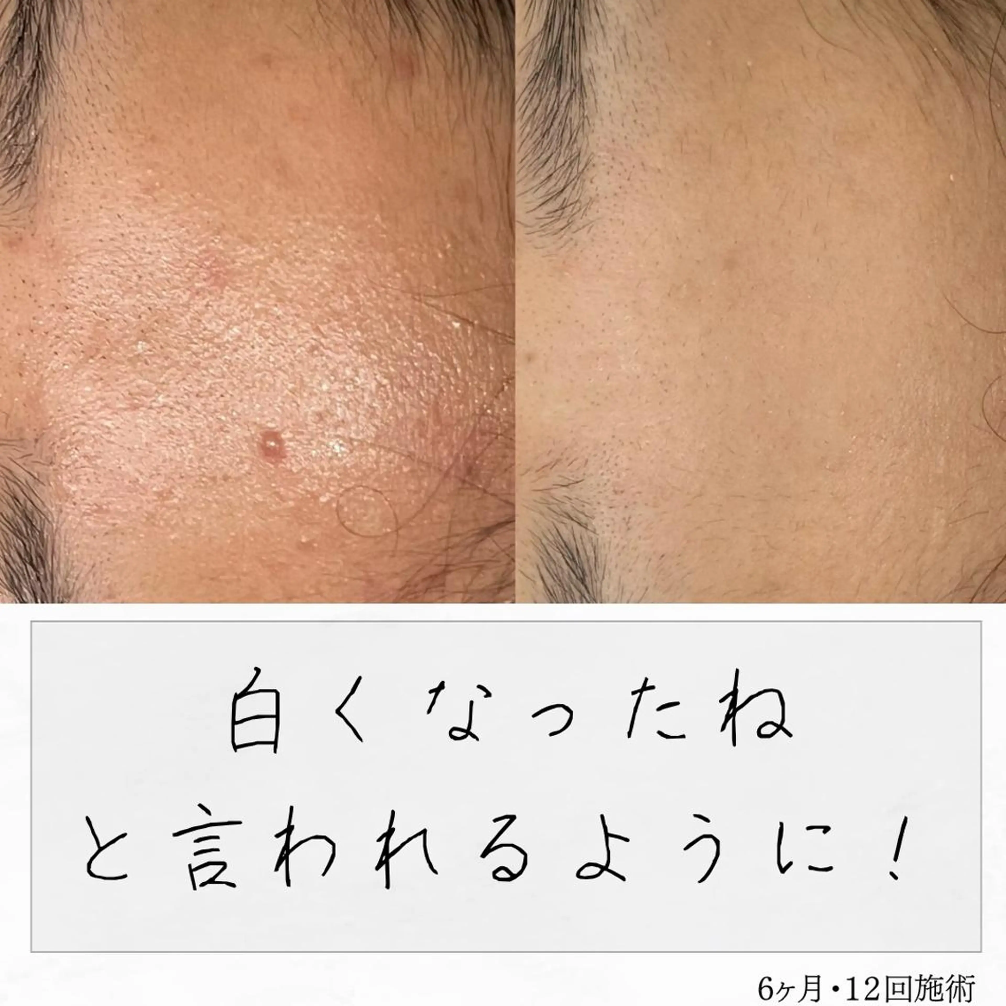 ニキビ経験者が施術 する専門サロン🌻のエステ・リラクイメージ