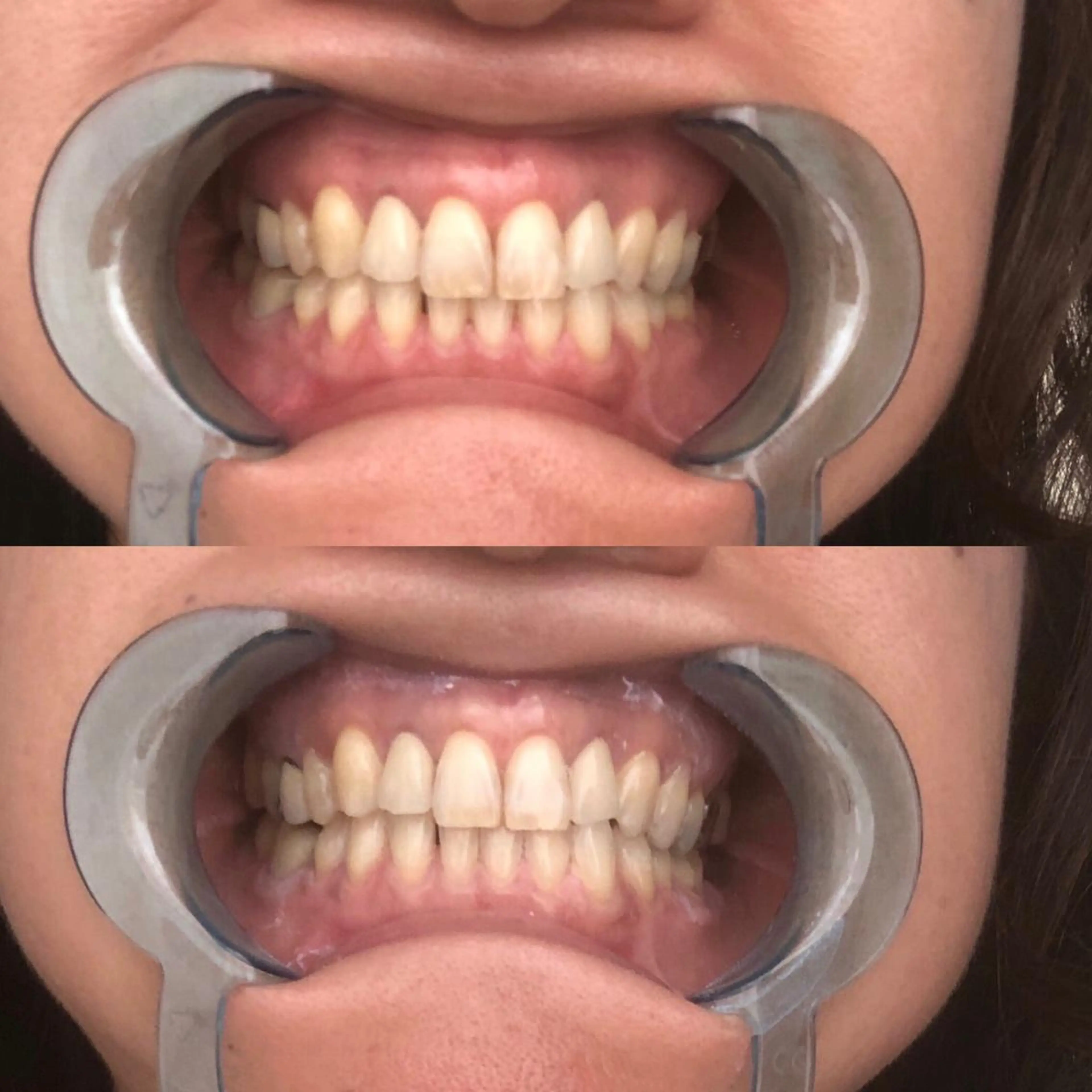 R E O T I A R A（レオティアラ）所属・高屋 昌子のその他イメージ