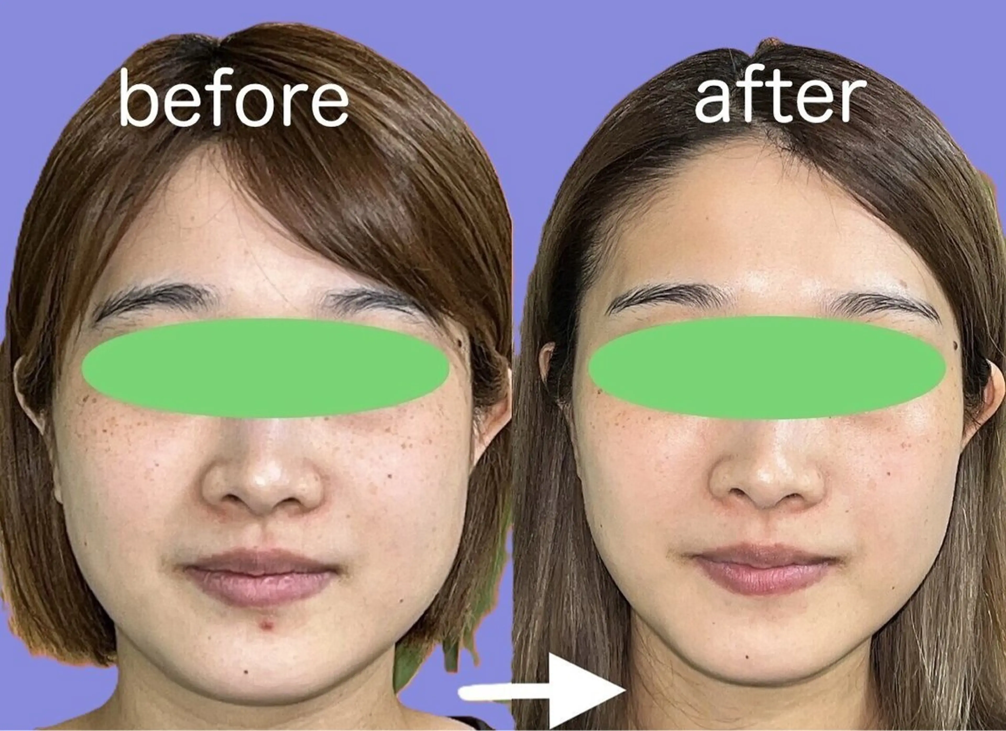 エステ リラク 春日井トータルからだ サロンふくふくのエステ・リラクイメージ