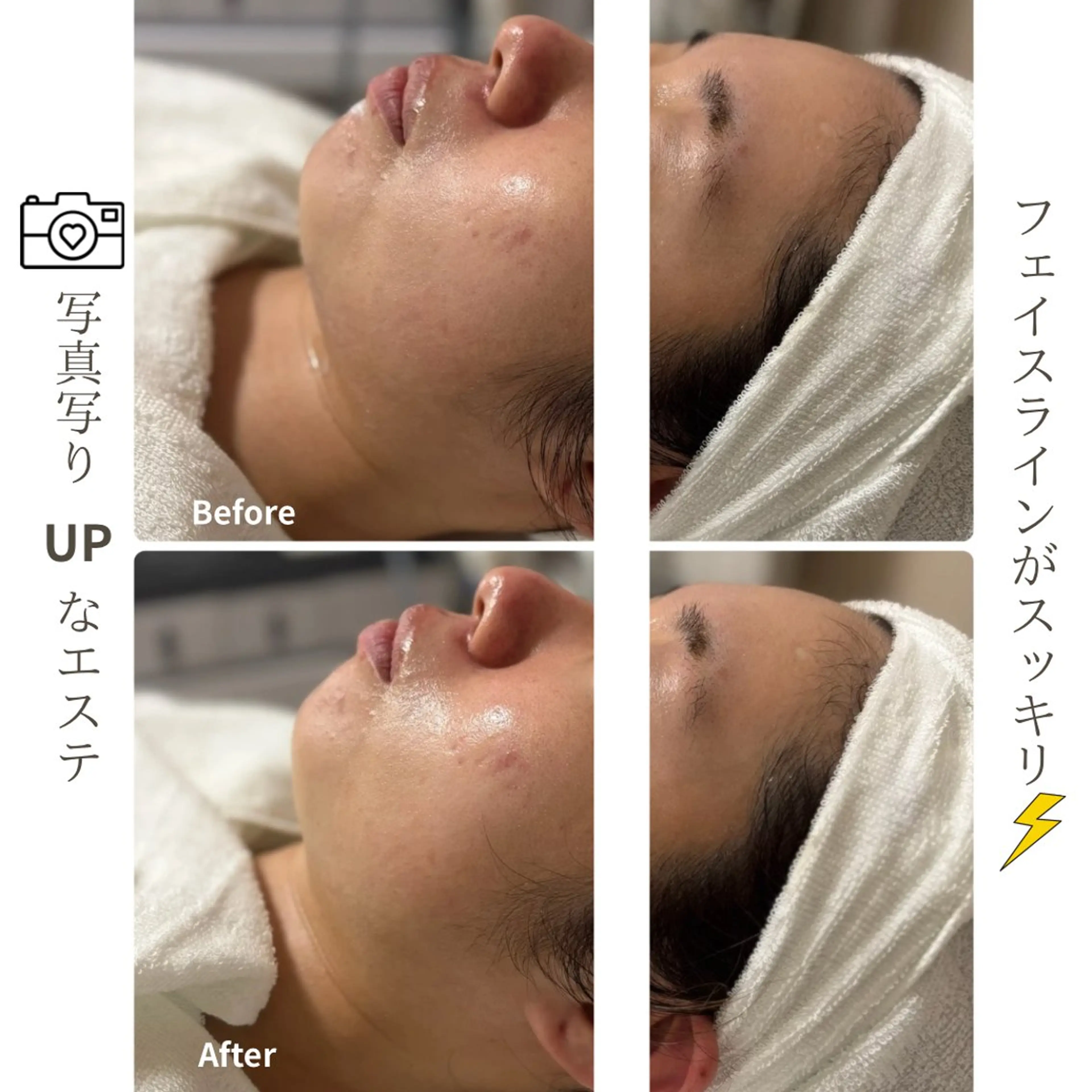 エステ 姫路/肌質改善 /やまもとのエステ・リラクイメージ