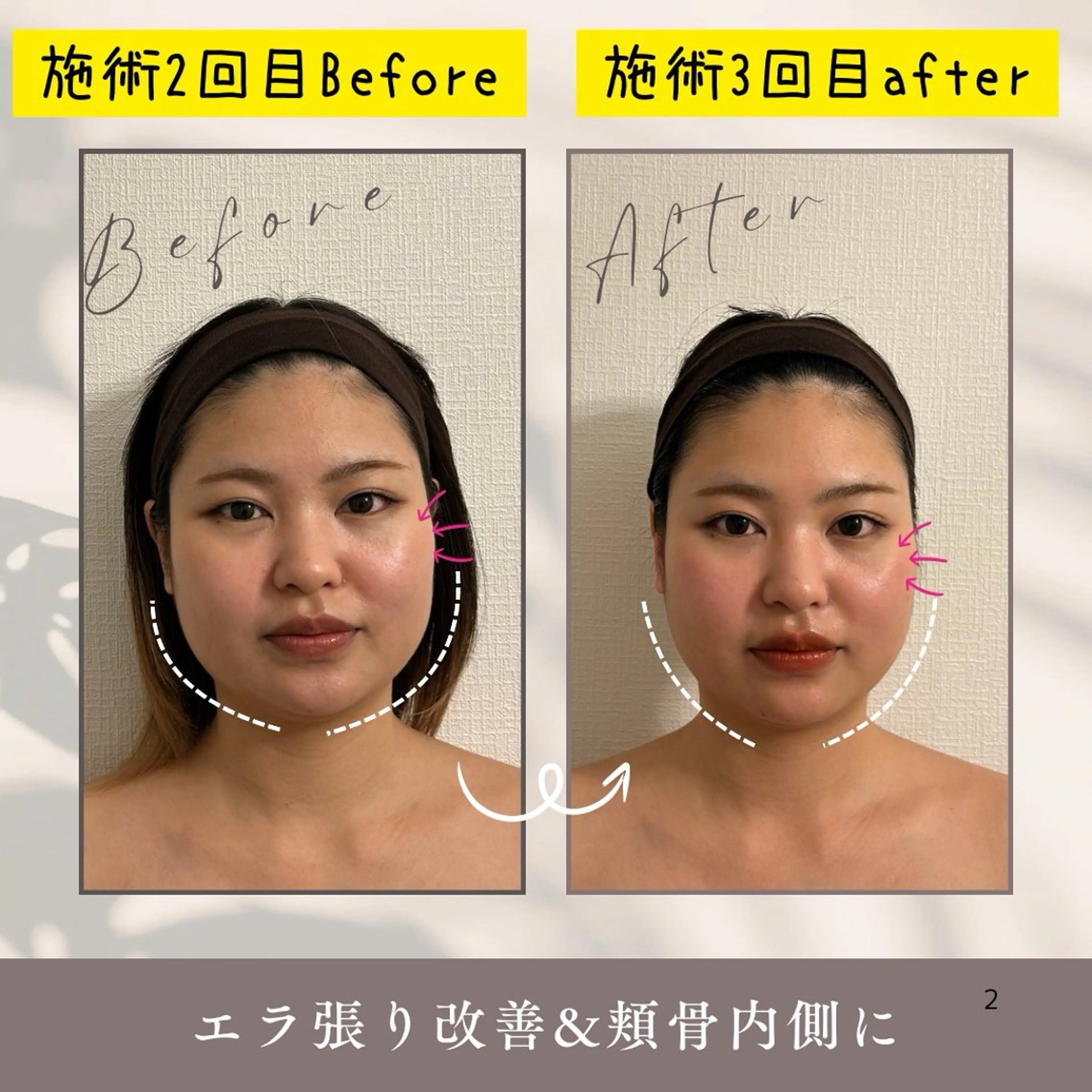 オーダーメイド小顔調整90分【時間内でデコルテ・肩首周りオイルマッサージ付】の写真