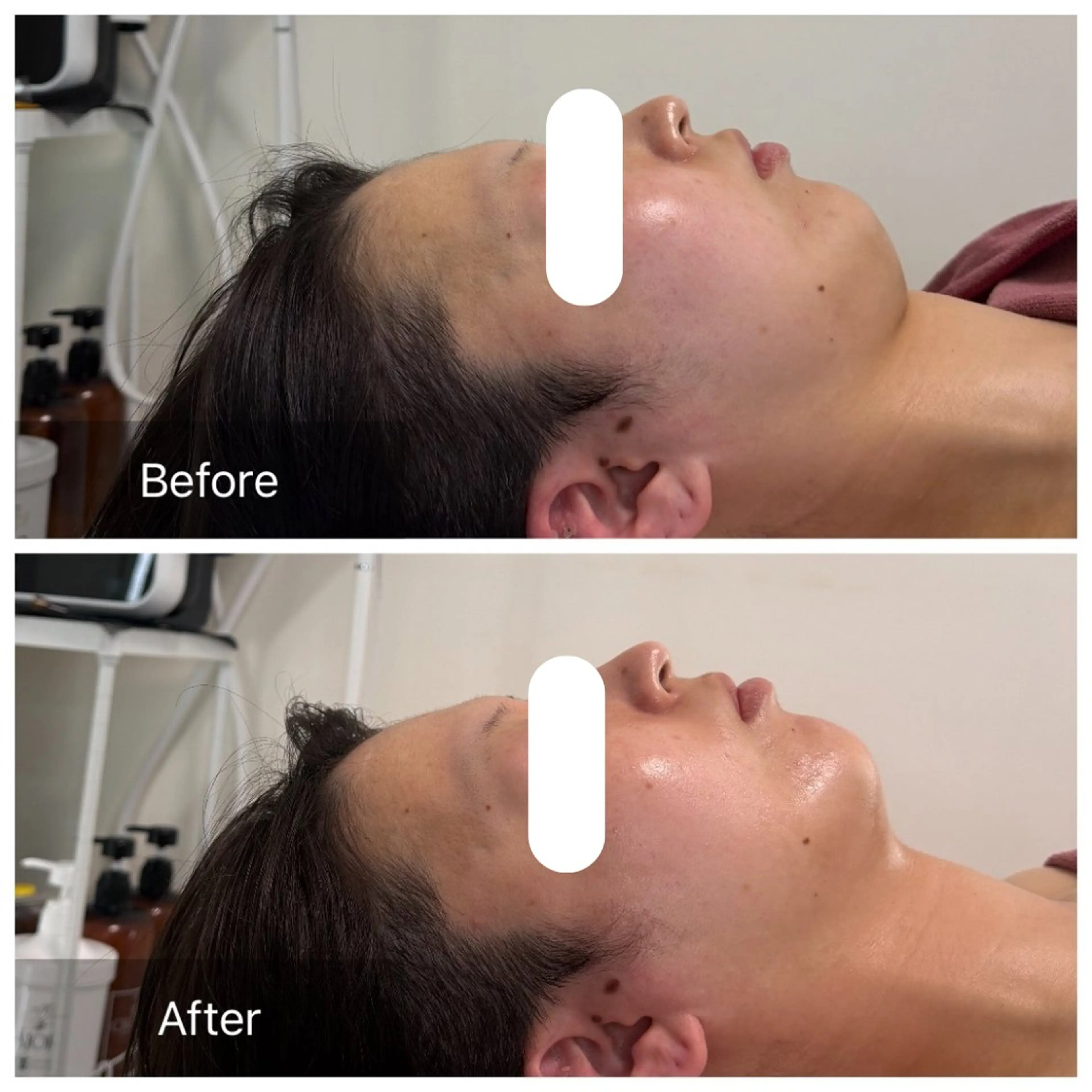 エステ リラク 池田 桃花のエステ・リラクイメージ