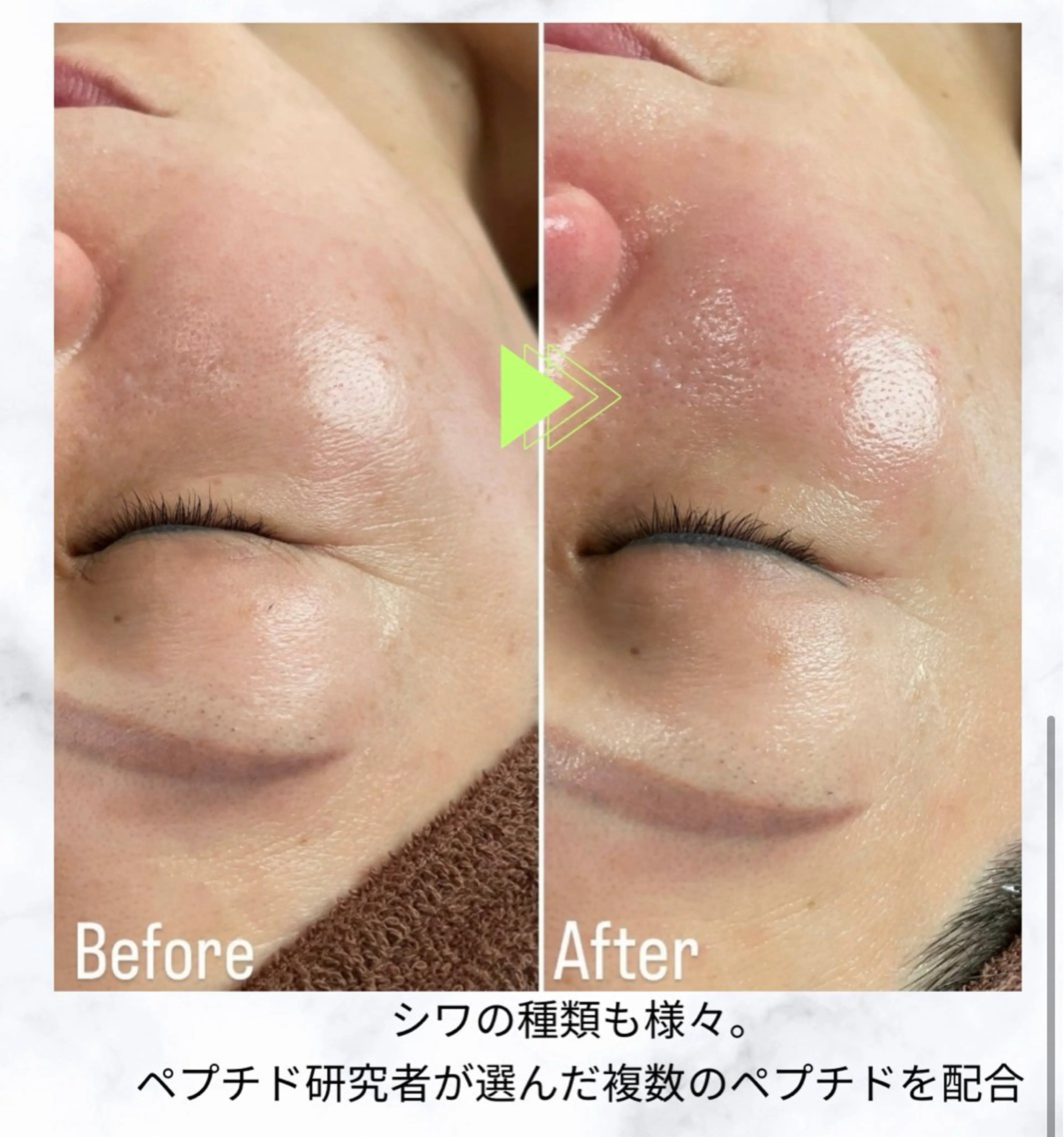 体感した事のないツヤ肌、本気で肌を育てたい方への写真