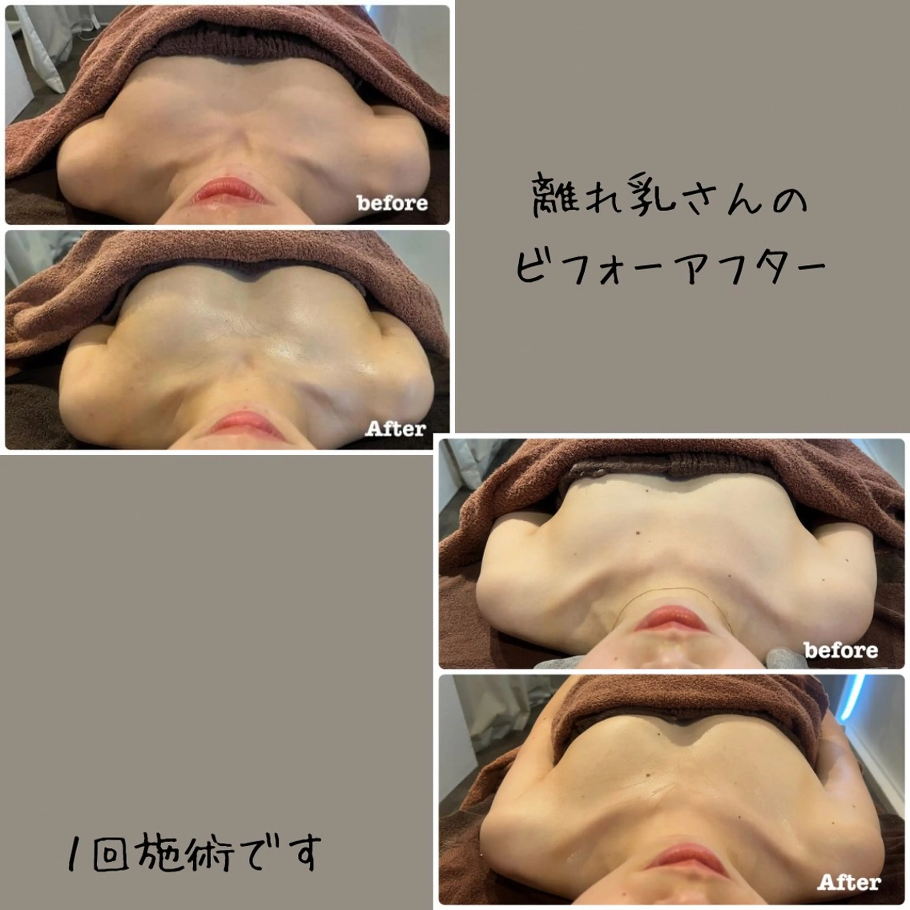 エステ Salon de  CocoFran所属・Salon de CocoFranのその他イメージ