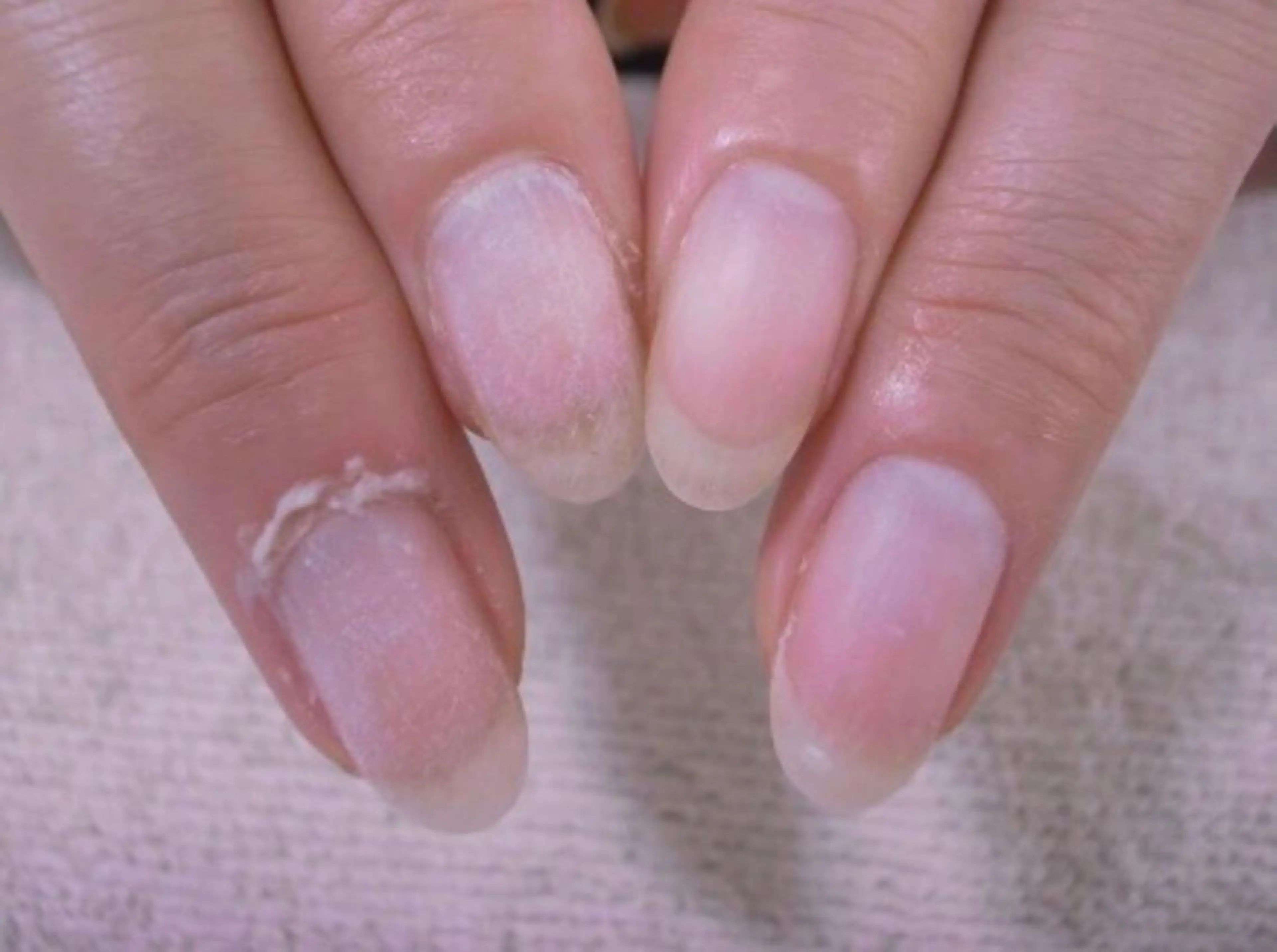 ネイル 北浦和 自爪育成ケアのネイルデザイン