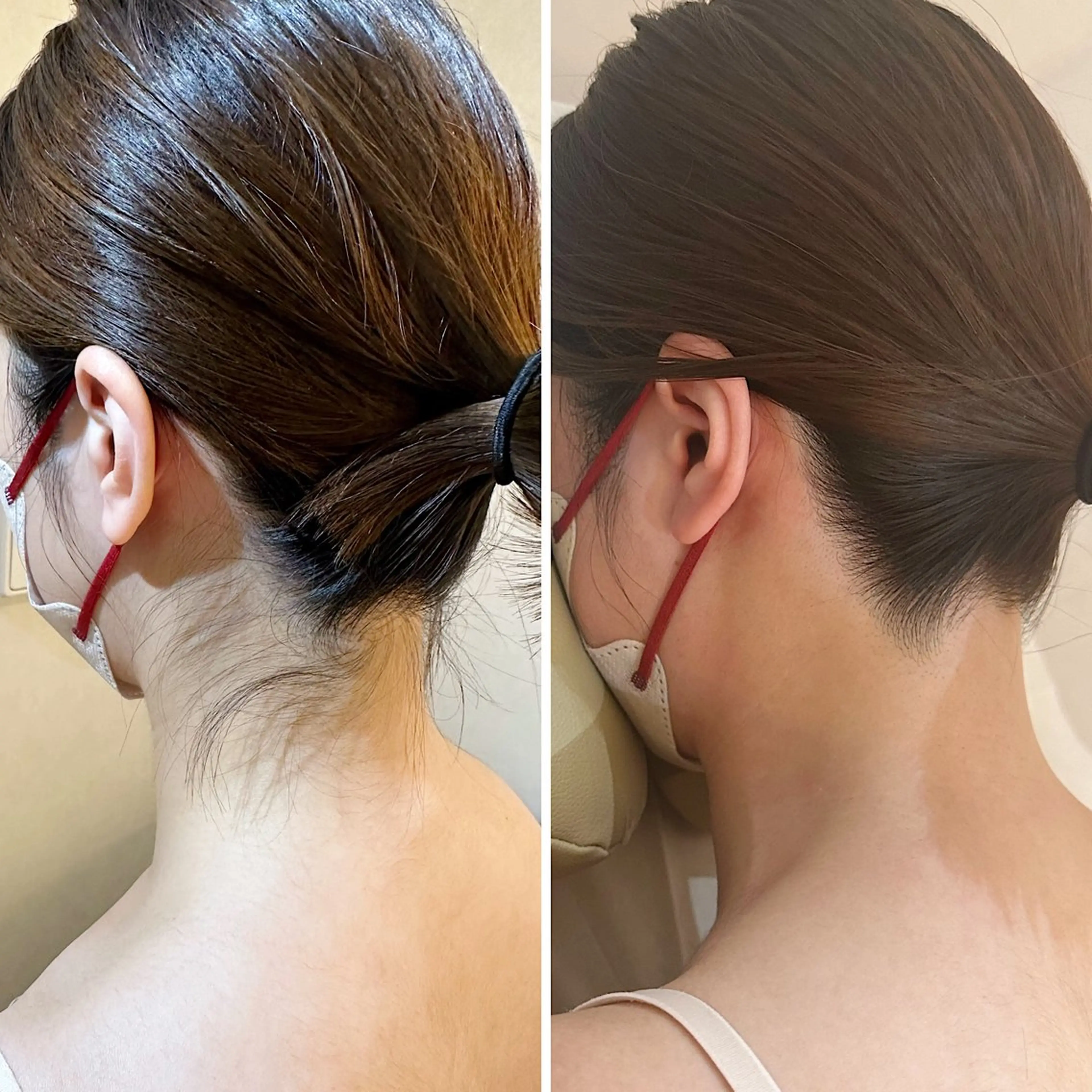 脱毛 うなじ脱毛/美肌脱毛 LABELのエステ・リラクイメージ