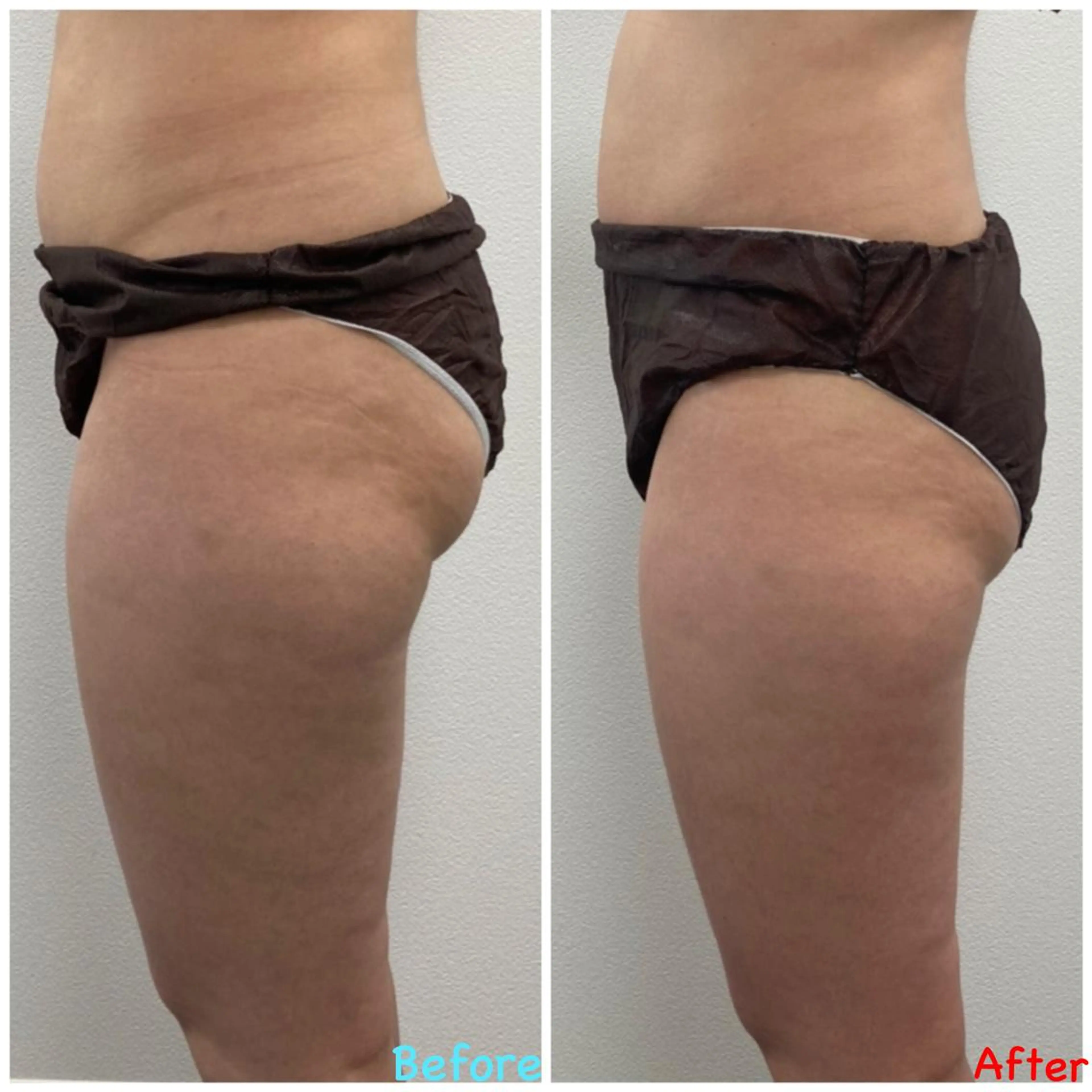 Linomalie エステ/たるみ/脱毛のエステ・リラクイメージ