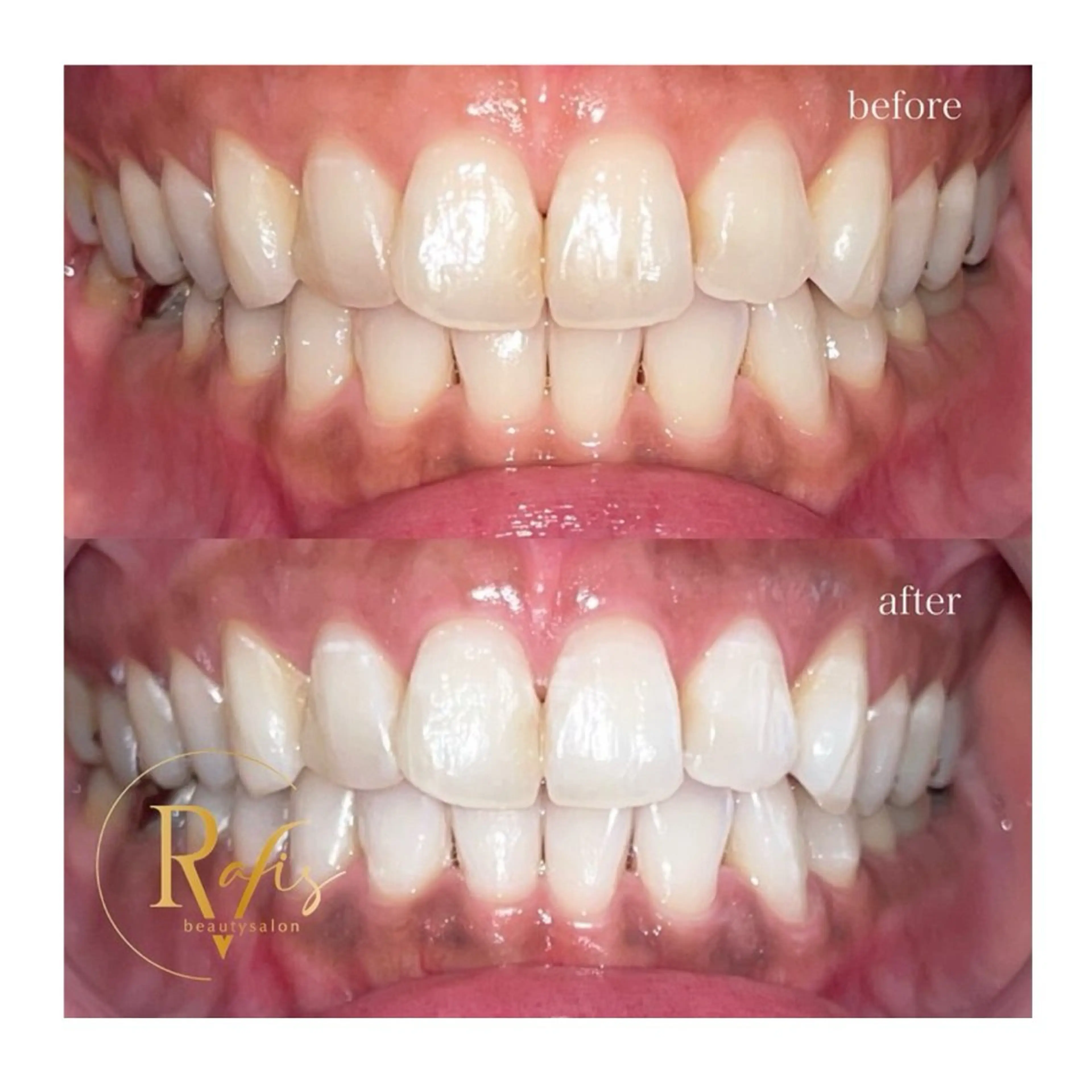 エステ 新石切ravis - ラヴィス -のその他イメージ