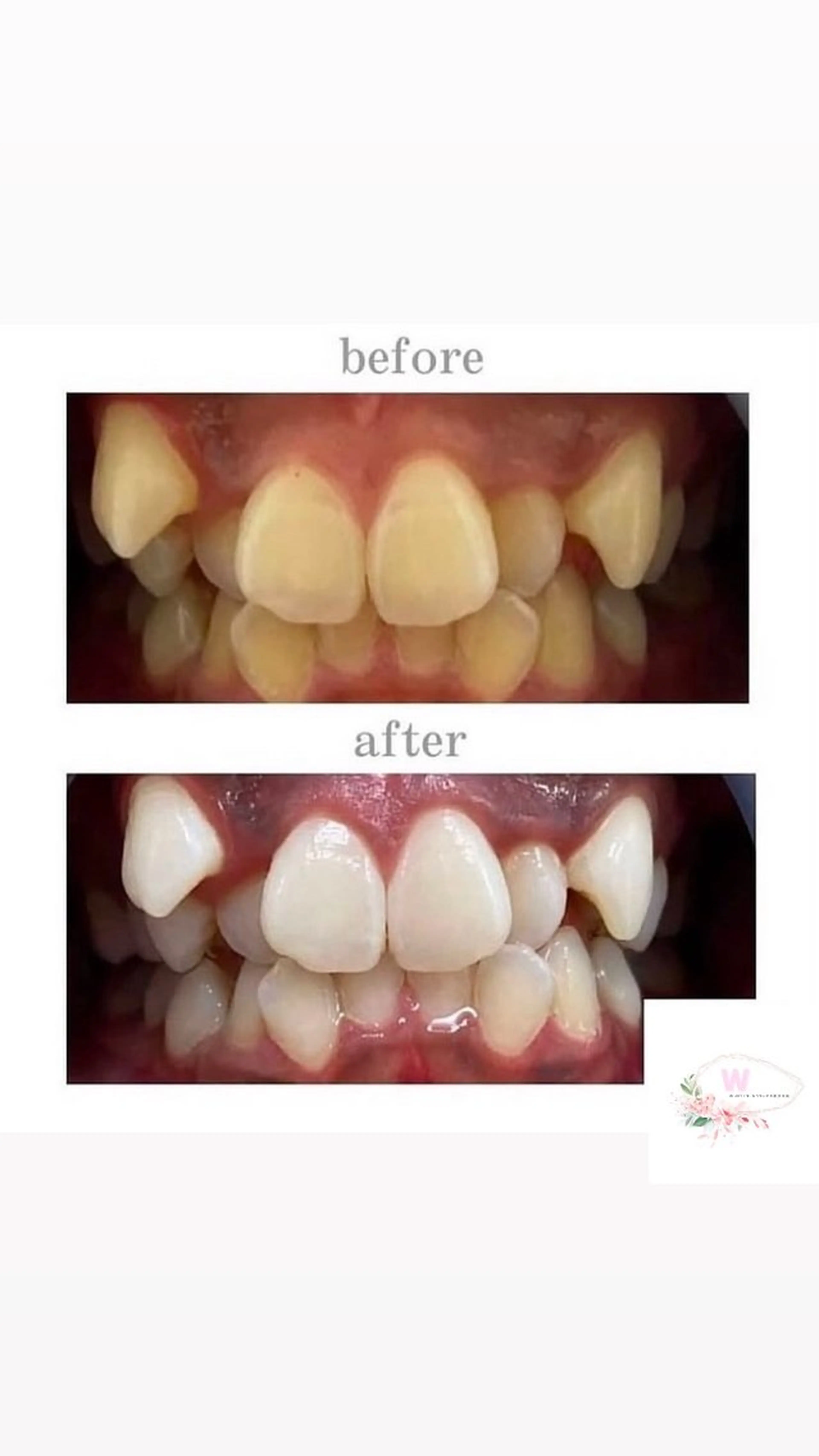 ホワイトニング ショップ本厚木のその他イメージ