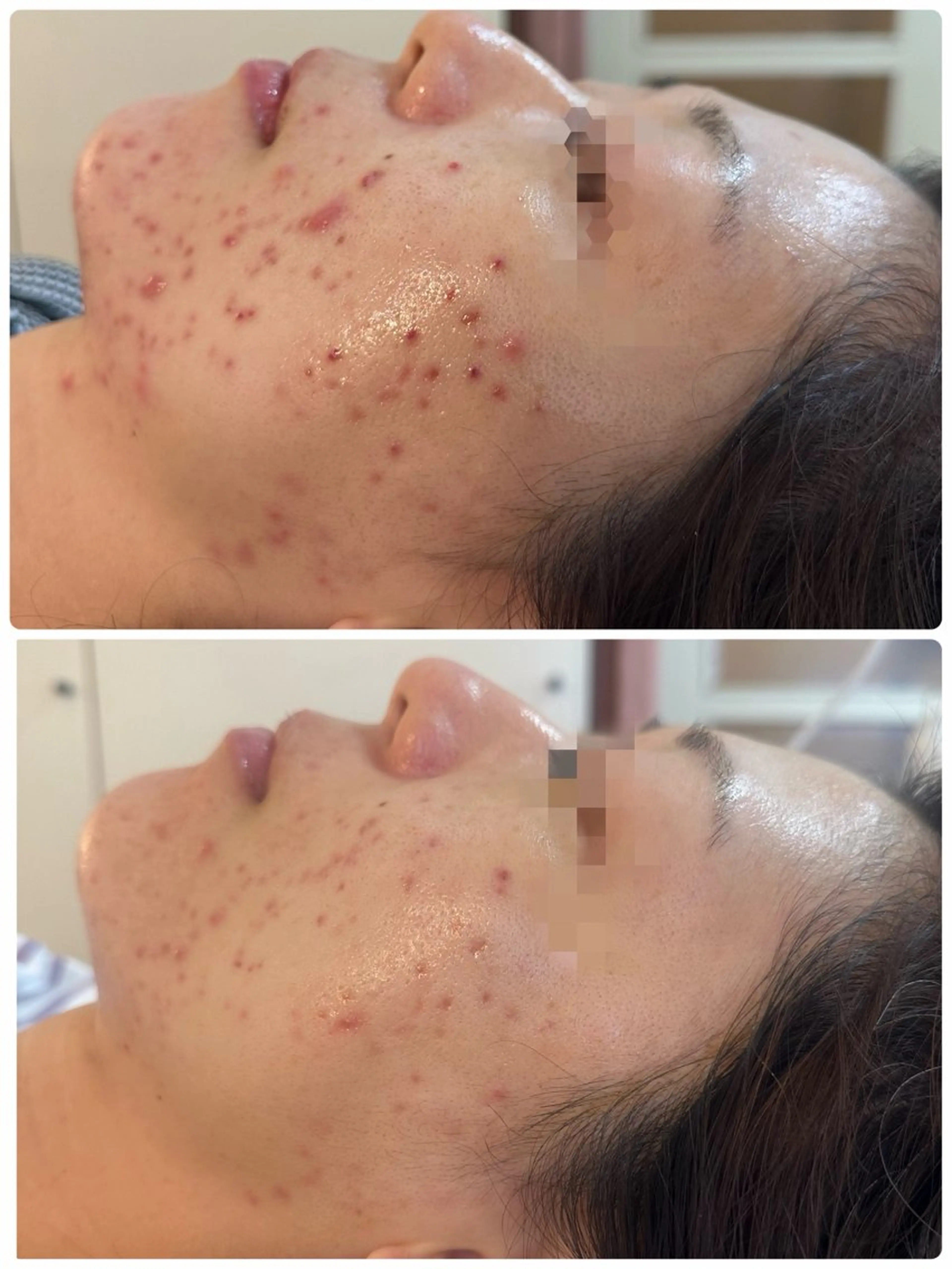 NICORI大宮 (看護師)塩野飛のエステ・リラクイメージ