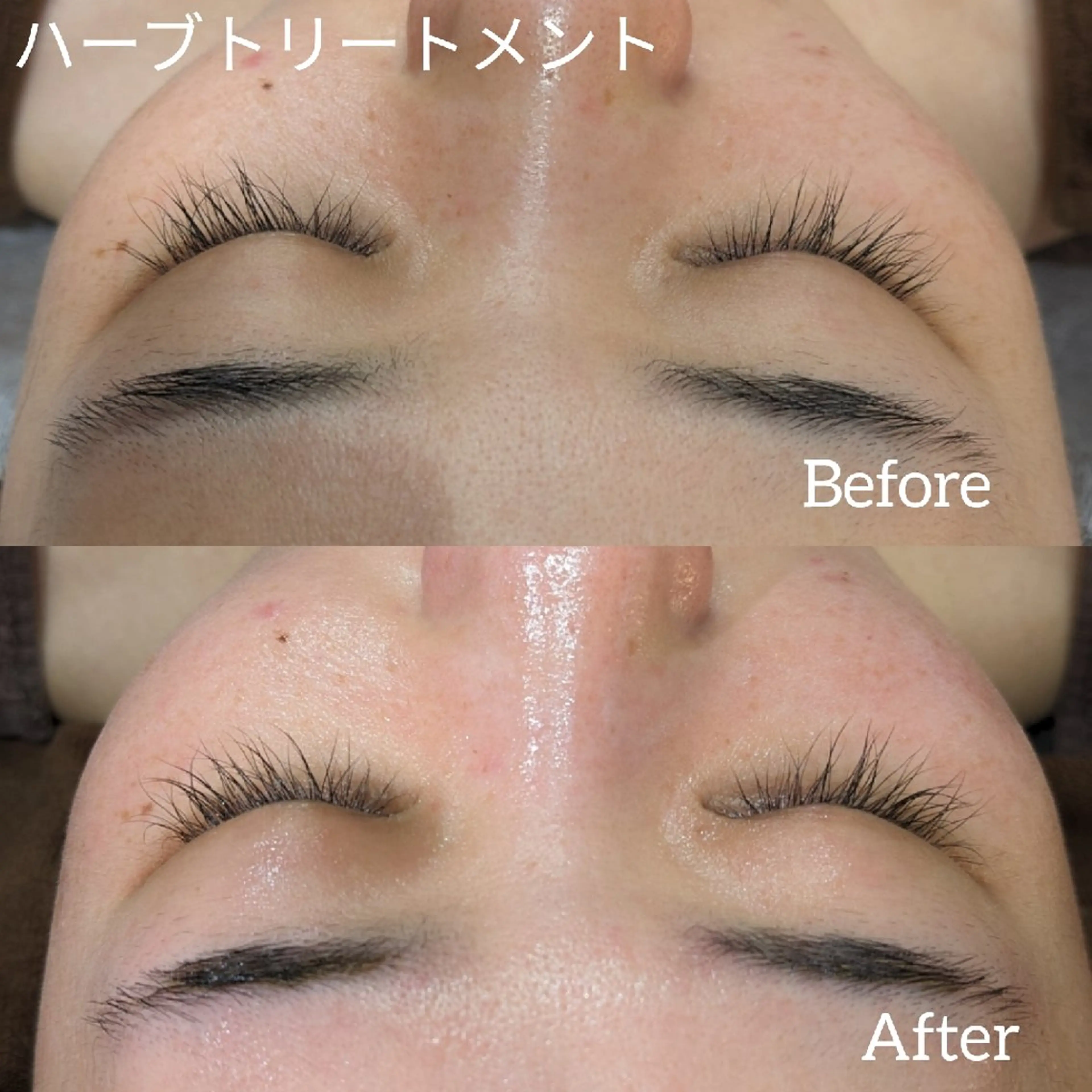 ﾌｪｲｼｬﾙｴｽﾃ ﾗﾄｩｰﾙ伊深のエステ・リラクイメージ