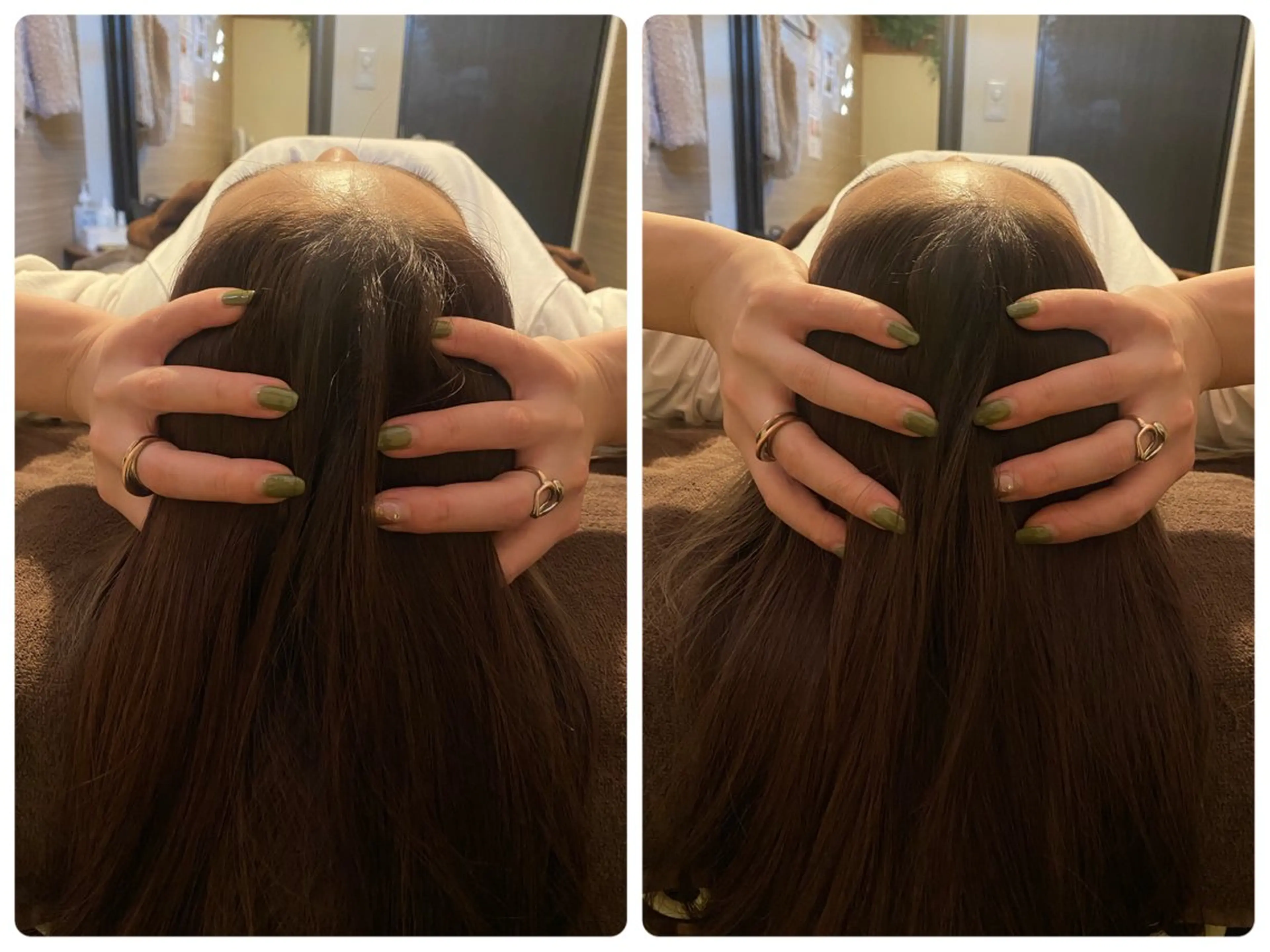 ハーブピーリング🌿 脱毛🧡ヘッドスパのエステ・リラクイメージ