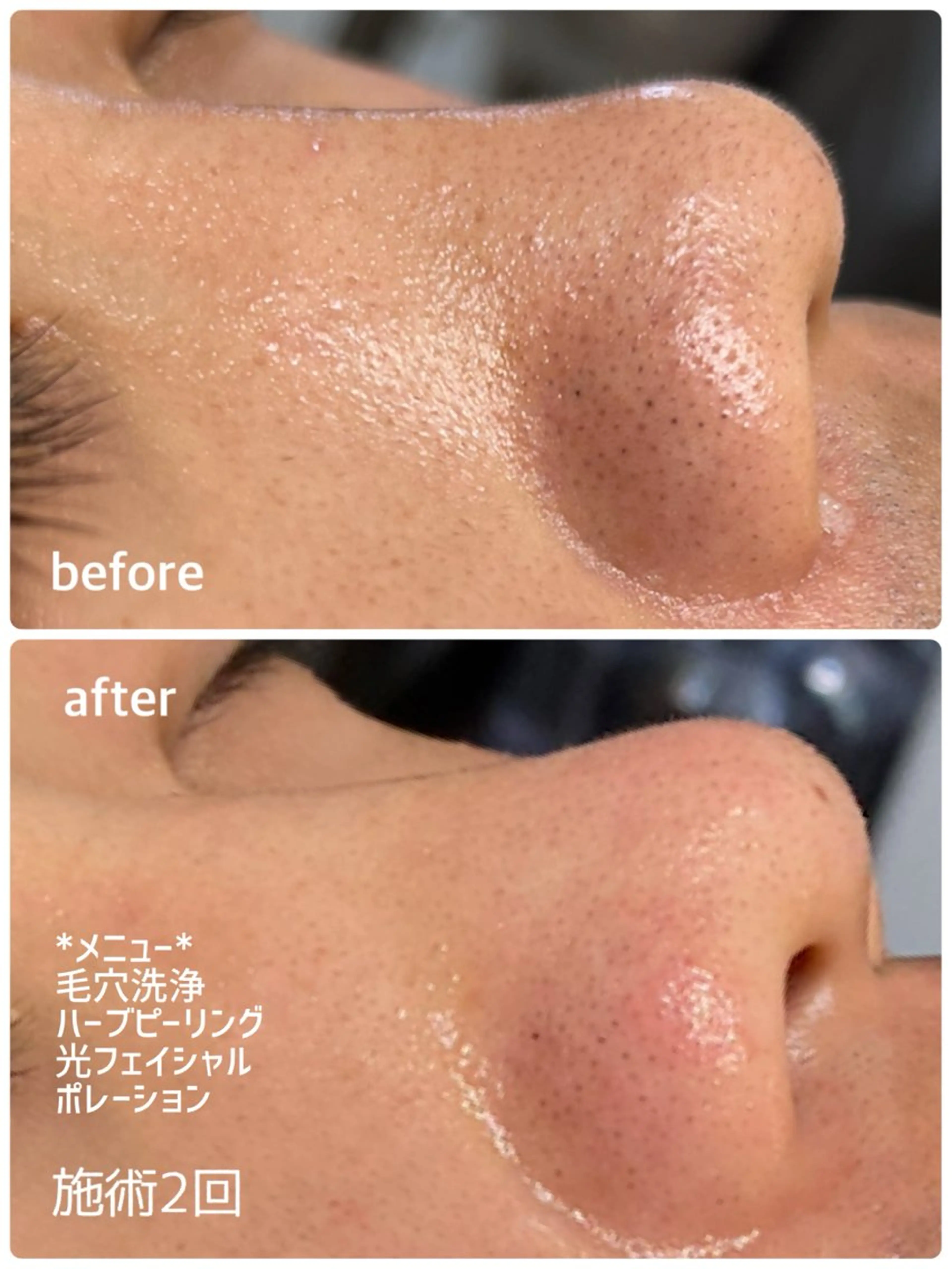 エステ LAESSE 恵比寿所属・毛穴と美白の専門店 LAESSE 恵比寿のエステ・リラクイメージ