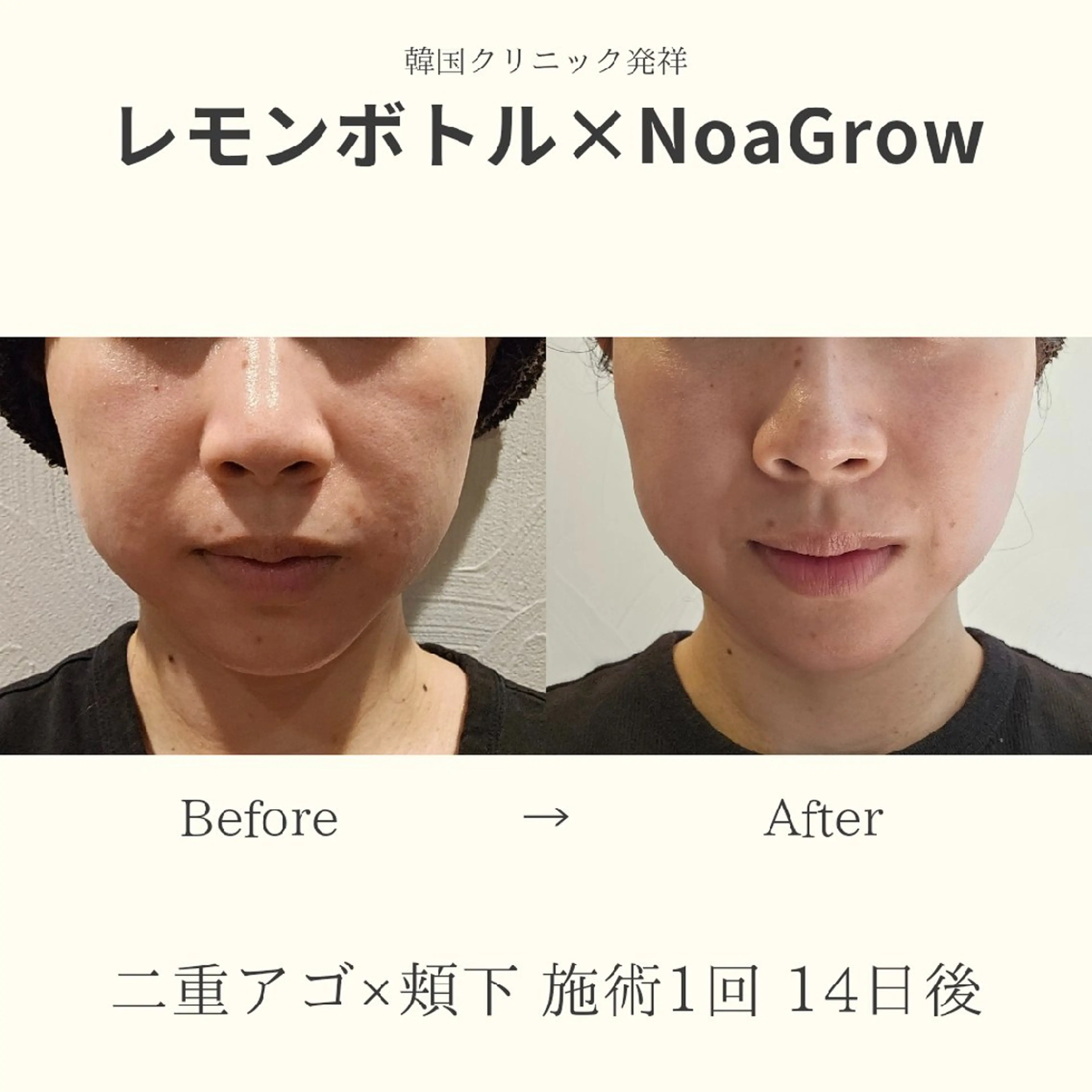 痩身小顔専門 アマテ ビューティー.Nのエステ・リラクイメージ