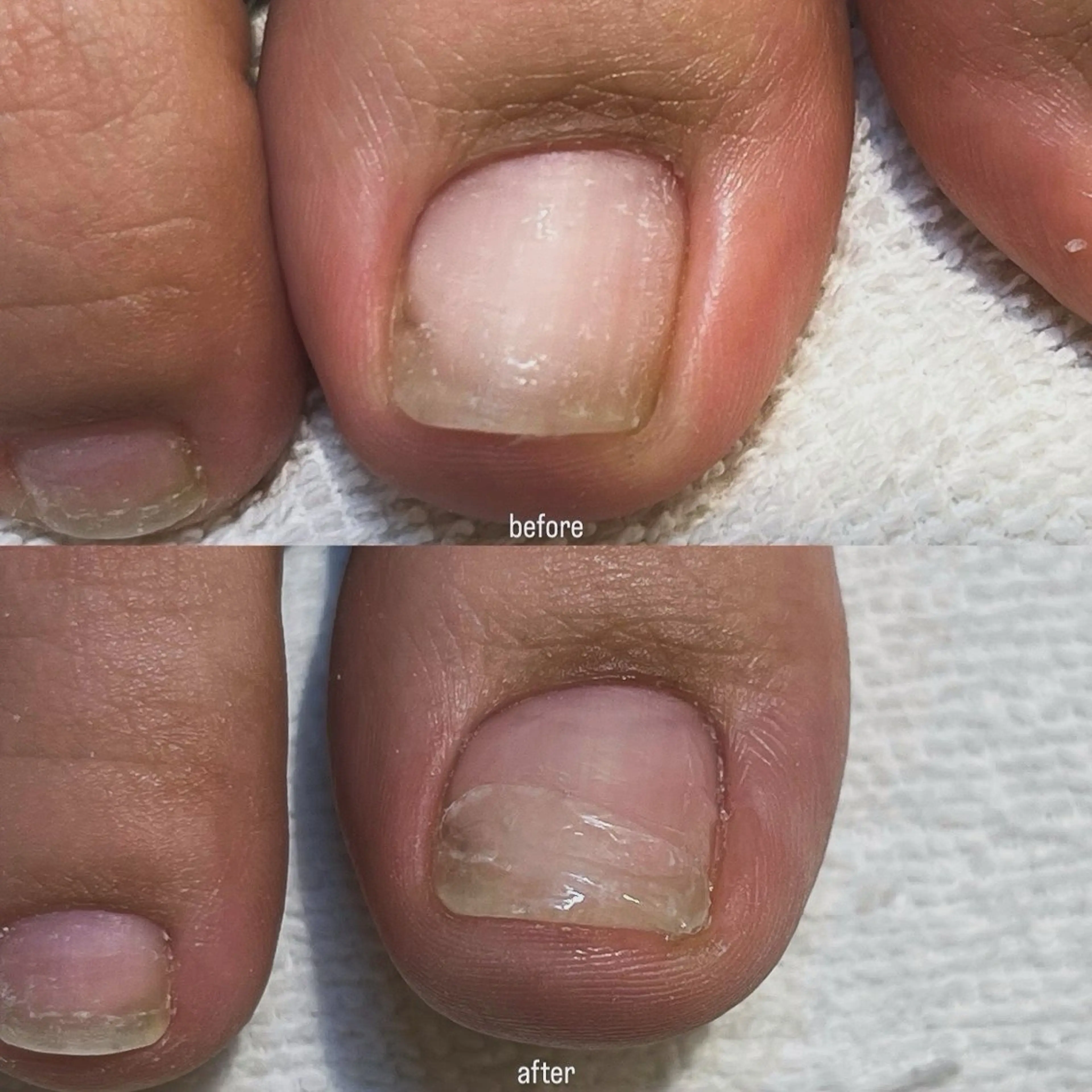 ネイル 𝗿𝗶𝗰𝗼 ˎˊ˗のネイルデザイン