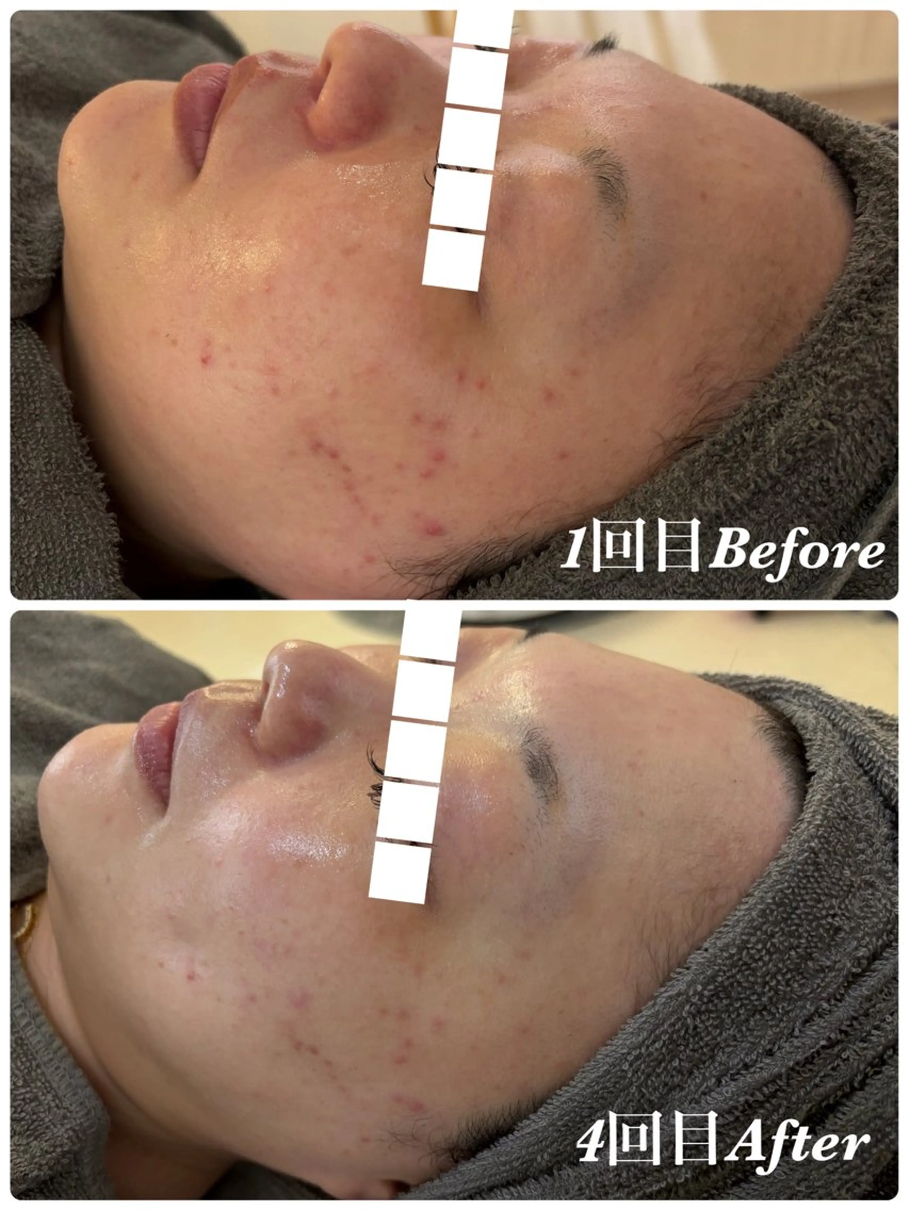 エステ Reine yukinaのエステ・リラクイメージ