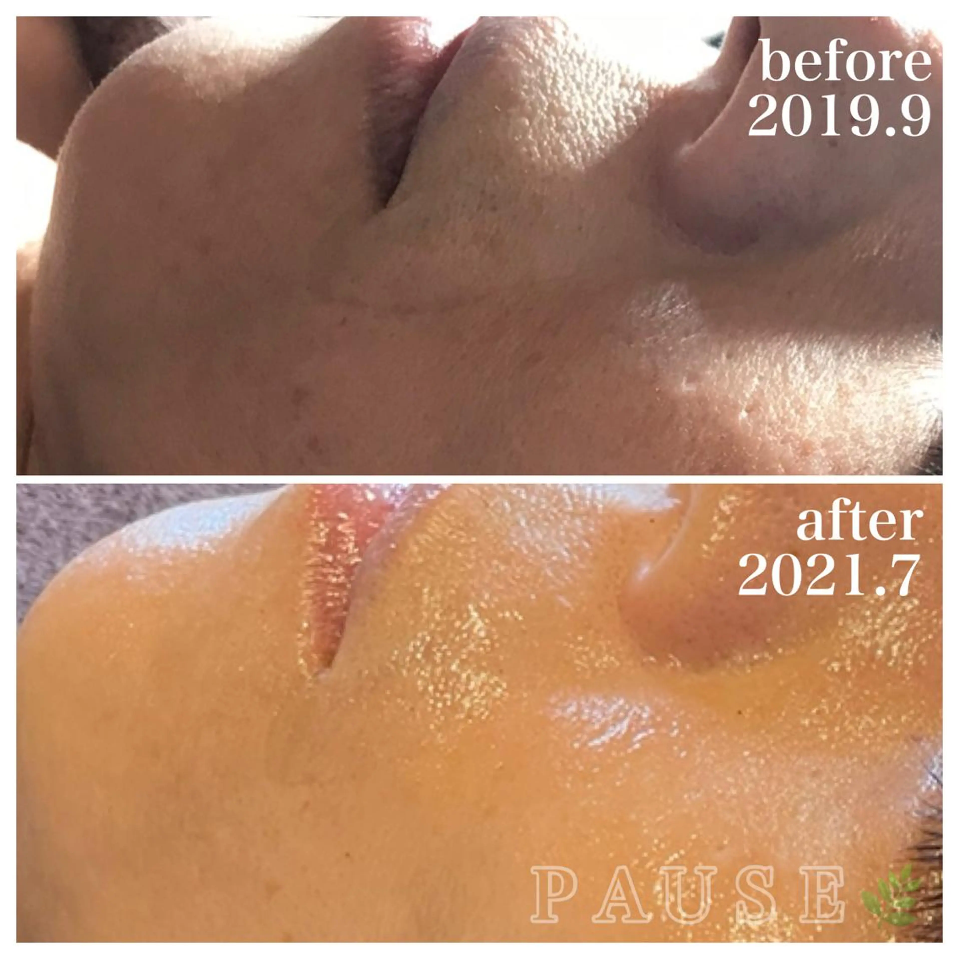 エステ 浜野 恵美のエステ・リラクイメージ