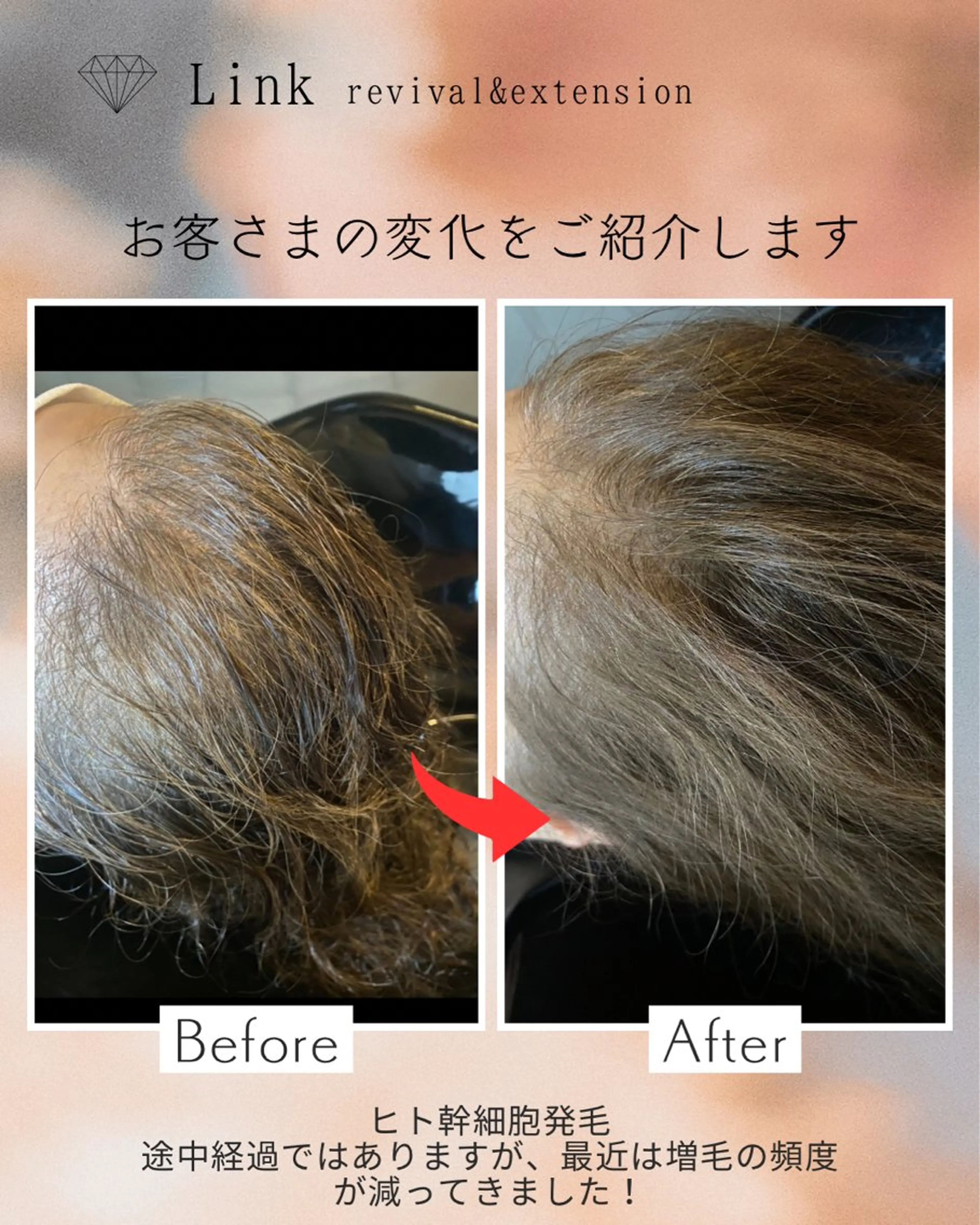 美容と育毛のサロン Link　松浦のマツエク・マツパデザイン