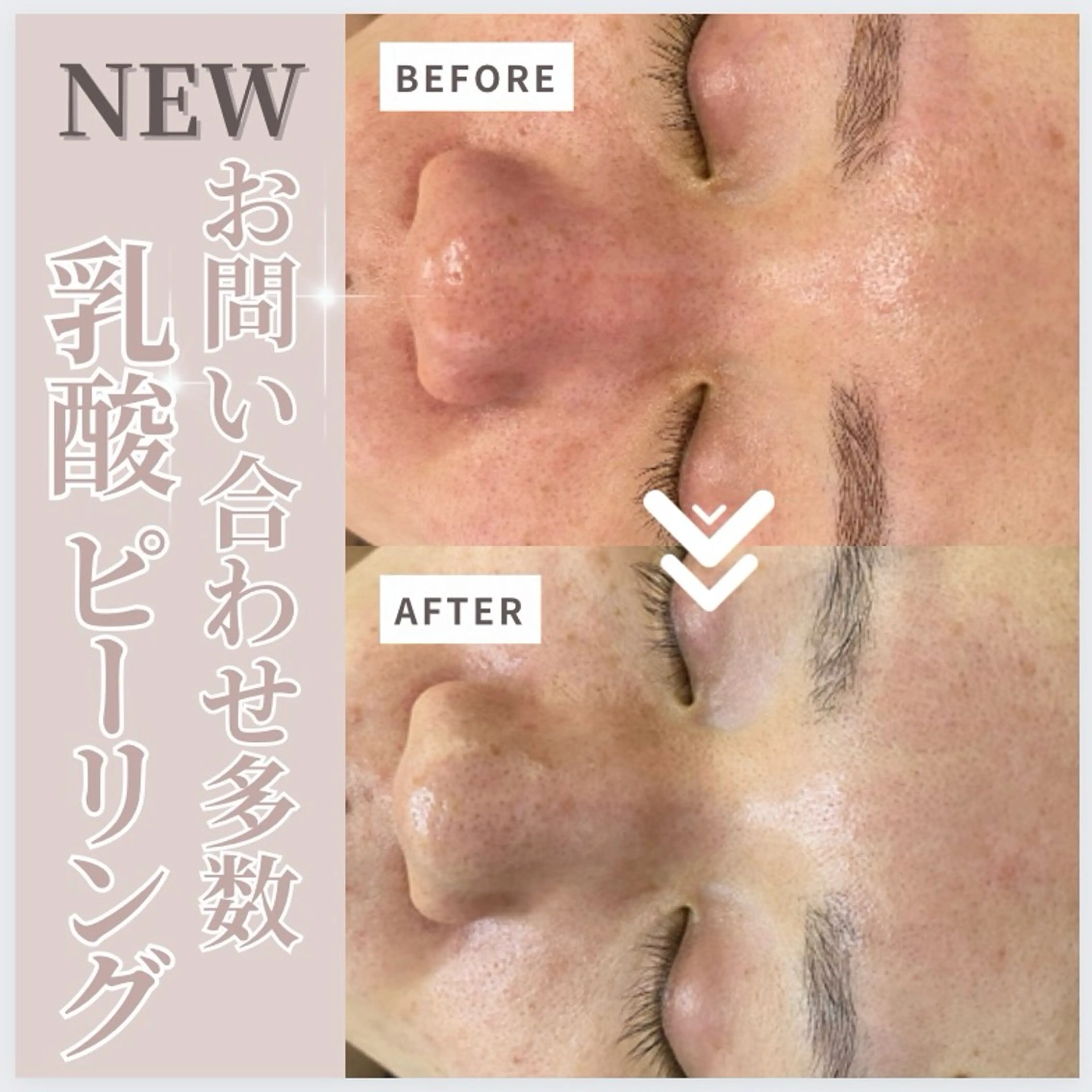 エステ ResetLab 佐藤 風香のエステ・リラクイメージ