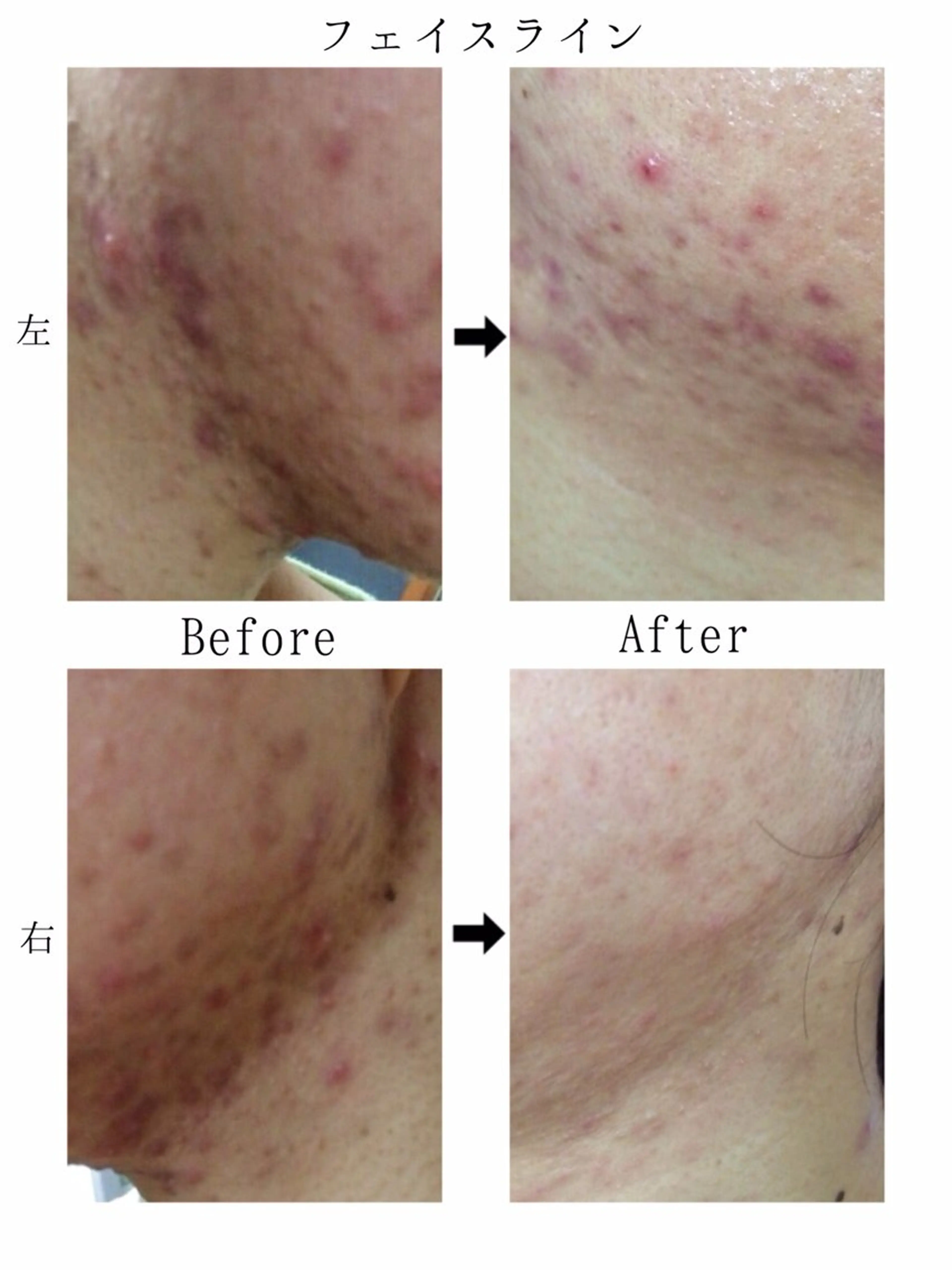 KalanDiva〜 ｶﾗﾝﾃﾞｨｰﾊﾞ〜のエステ・リラクイメージ