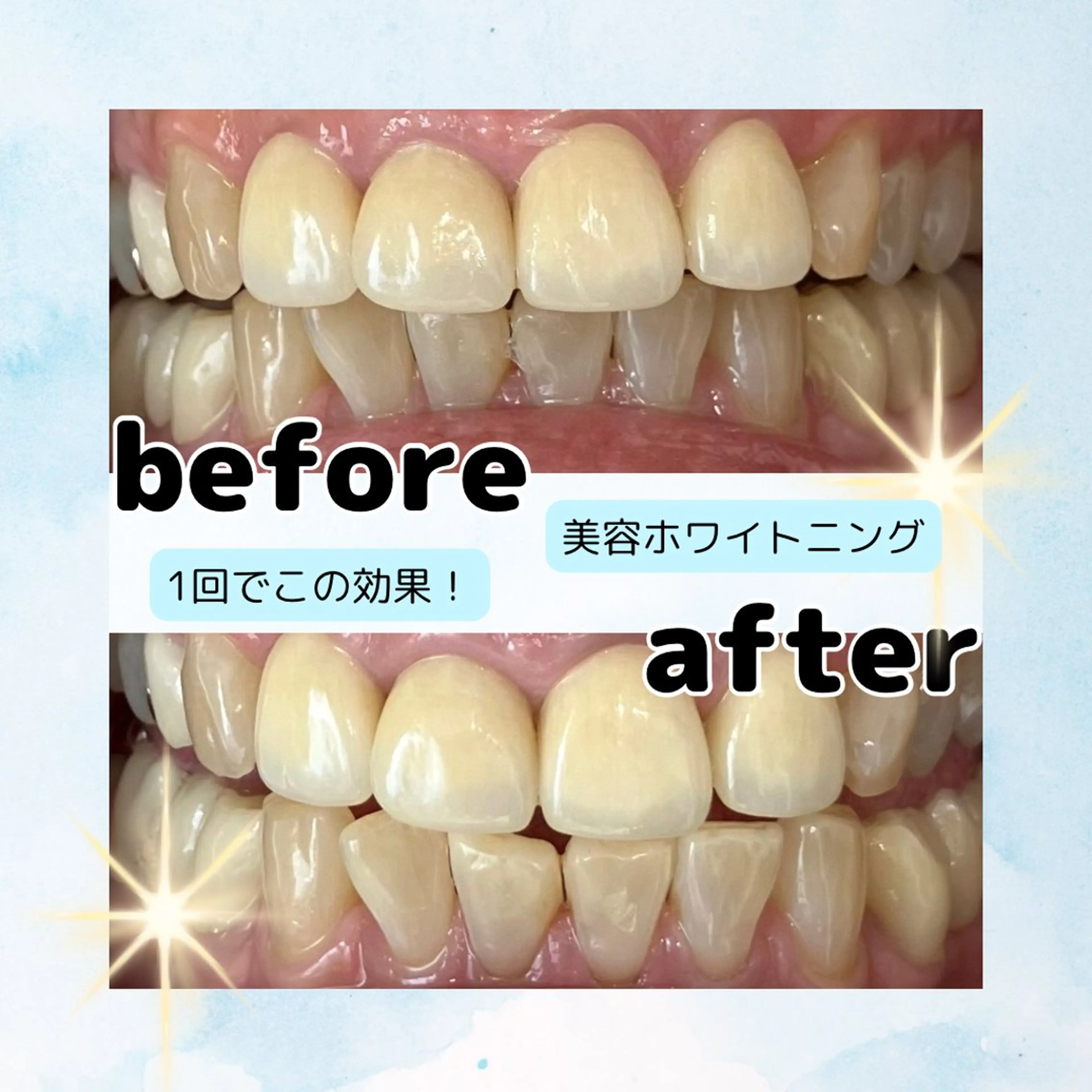 ホワイトニングサロン Soleilのその他イメージ