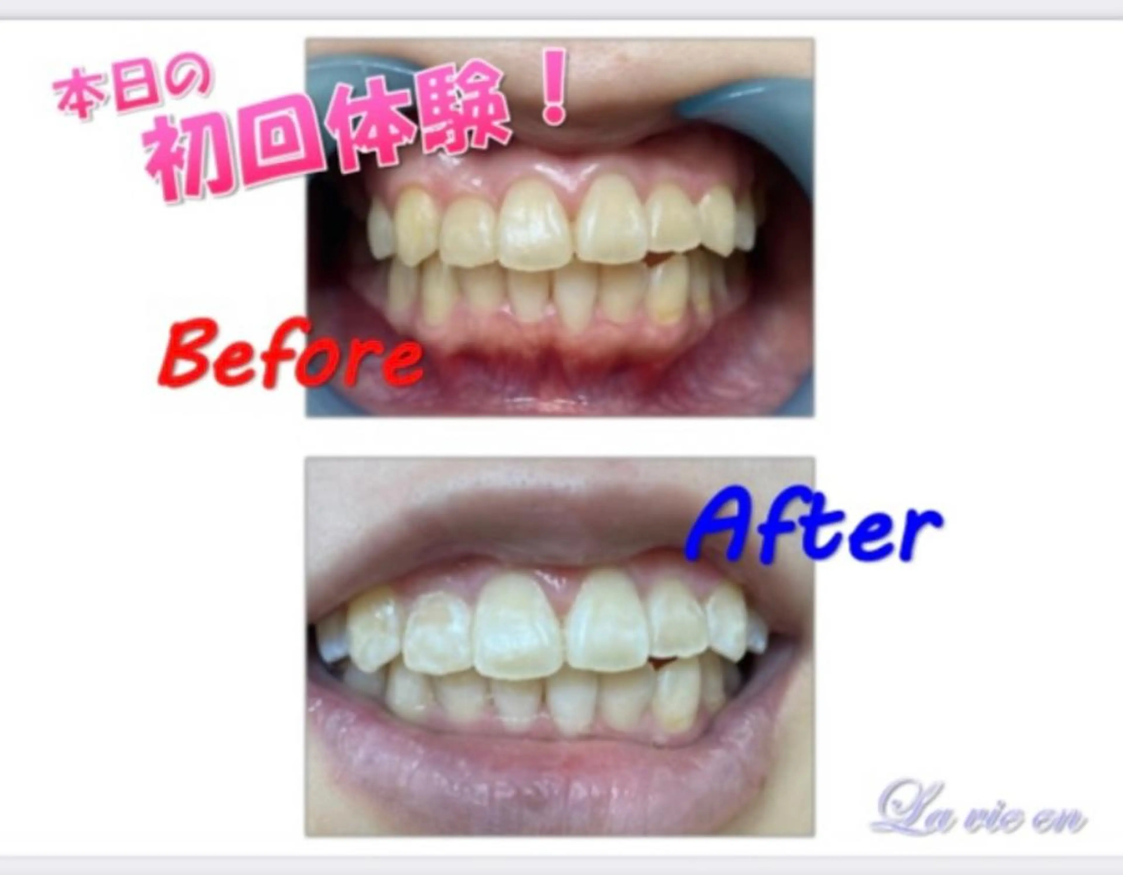 その他 セルフホワイトニングサロン　ラヴィアン所属・ホワイトニングサロン La vie enのその他イメージ
