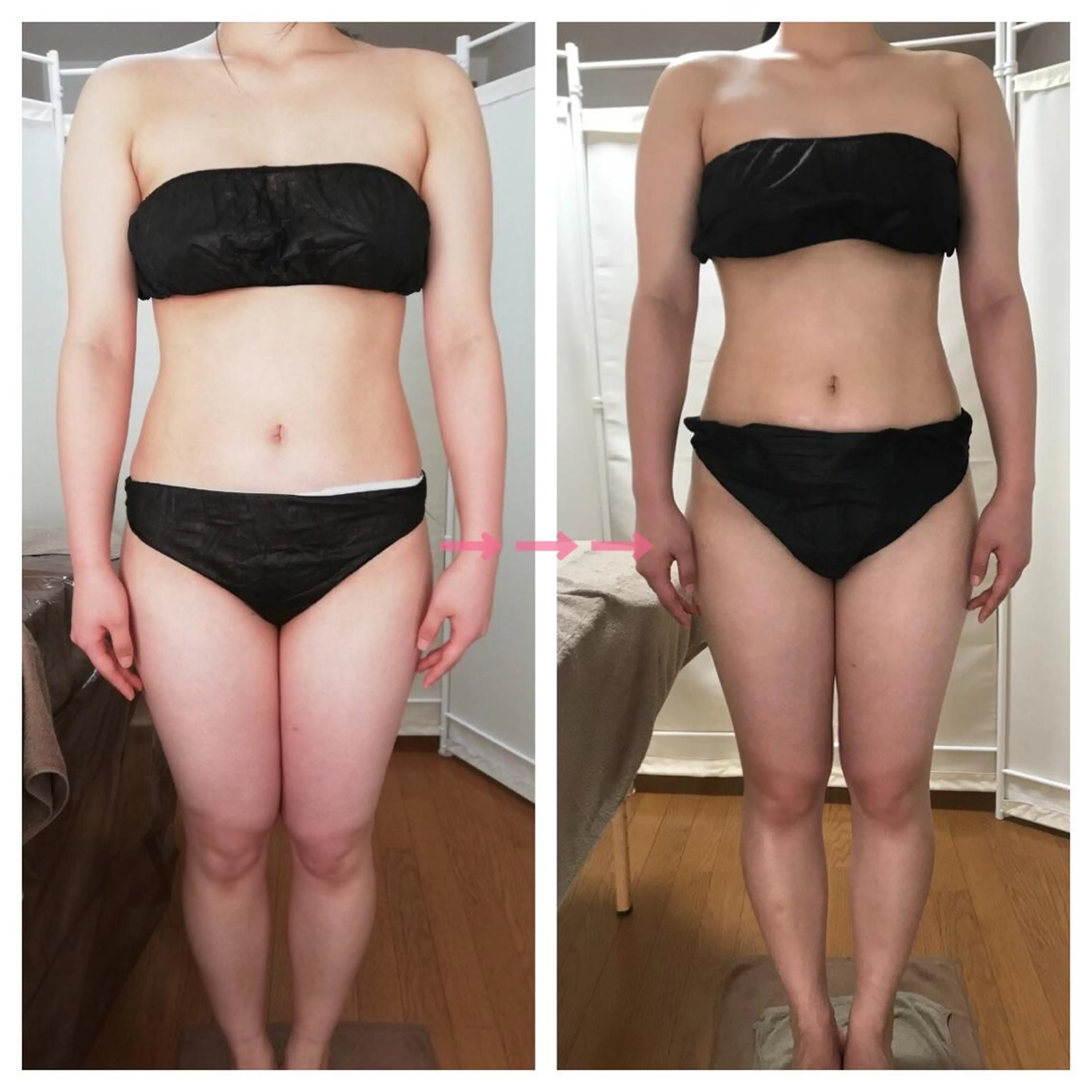 《本気痩せ×疲労改善 》  BILOOPのエステ・リラクイメージ