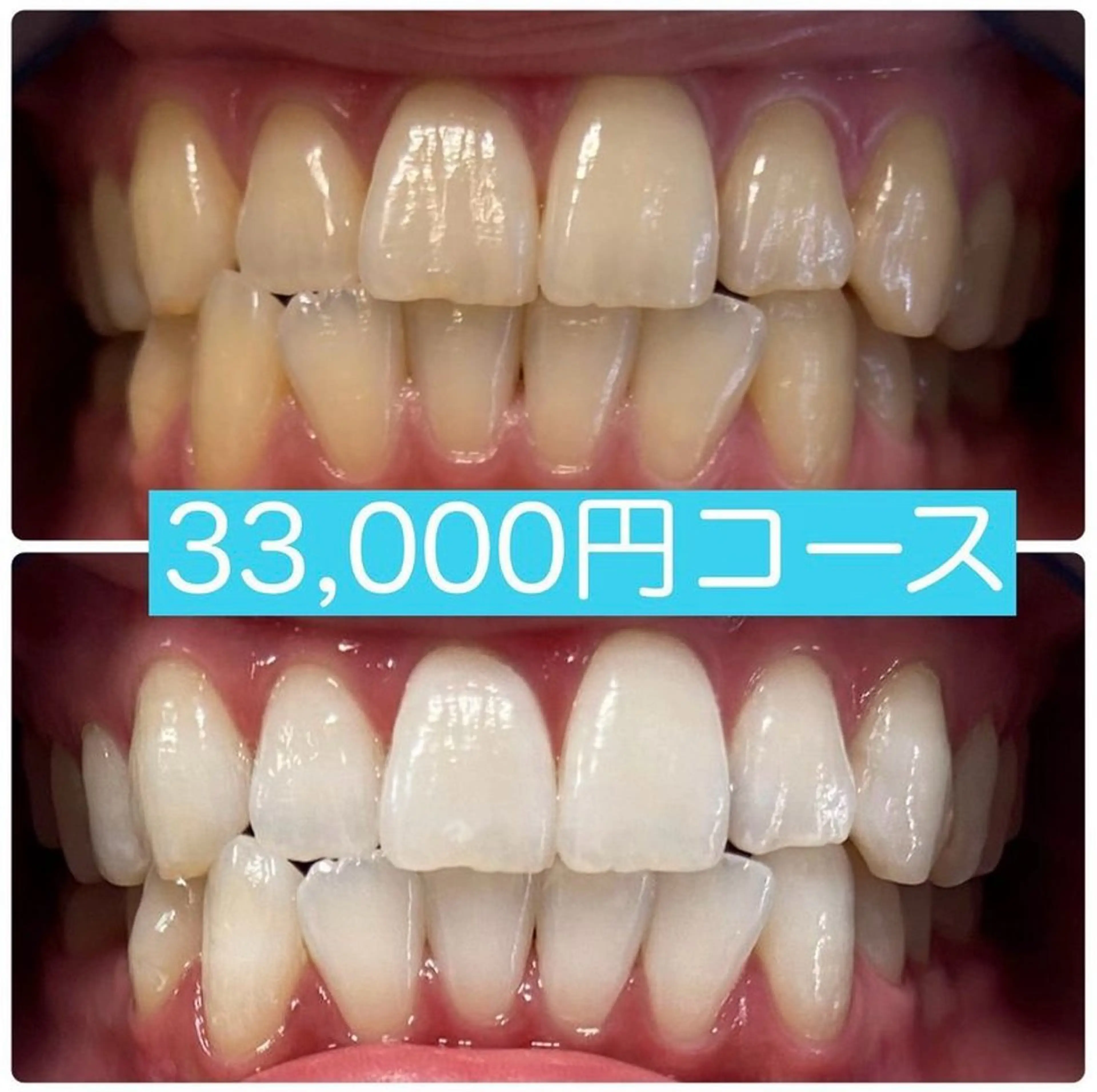 PLATINUM Beauty 横浜店所属・ホワイトニングルーム 横浜店のその他イメージ