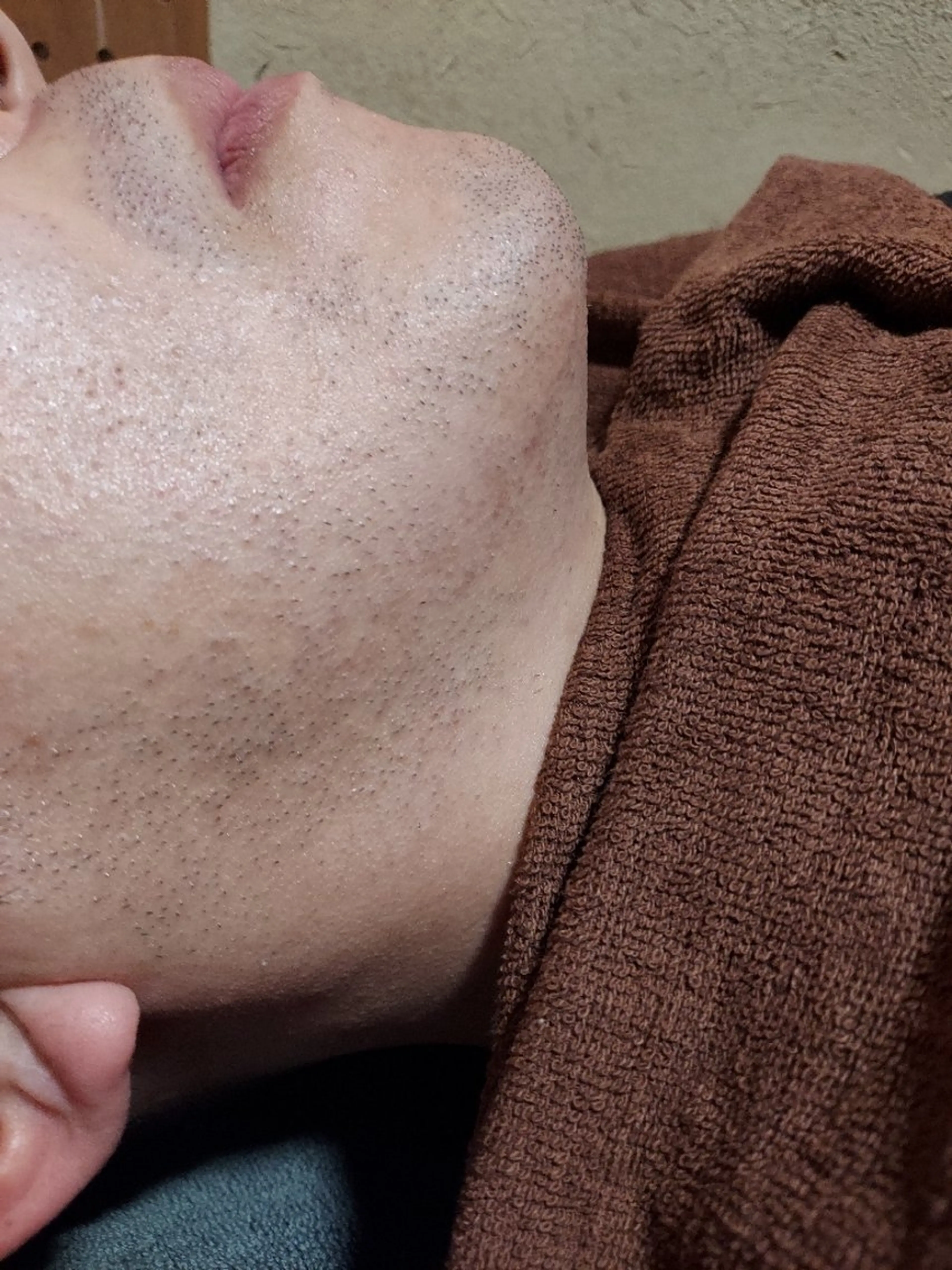 メンズ 脱毛 macheriena りなのエステ・リラクイメージ