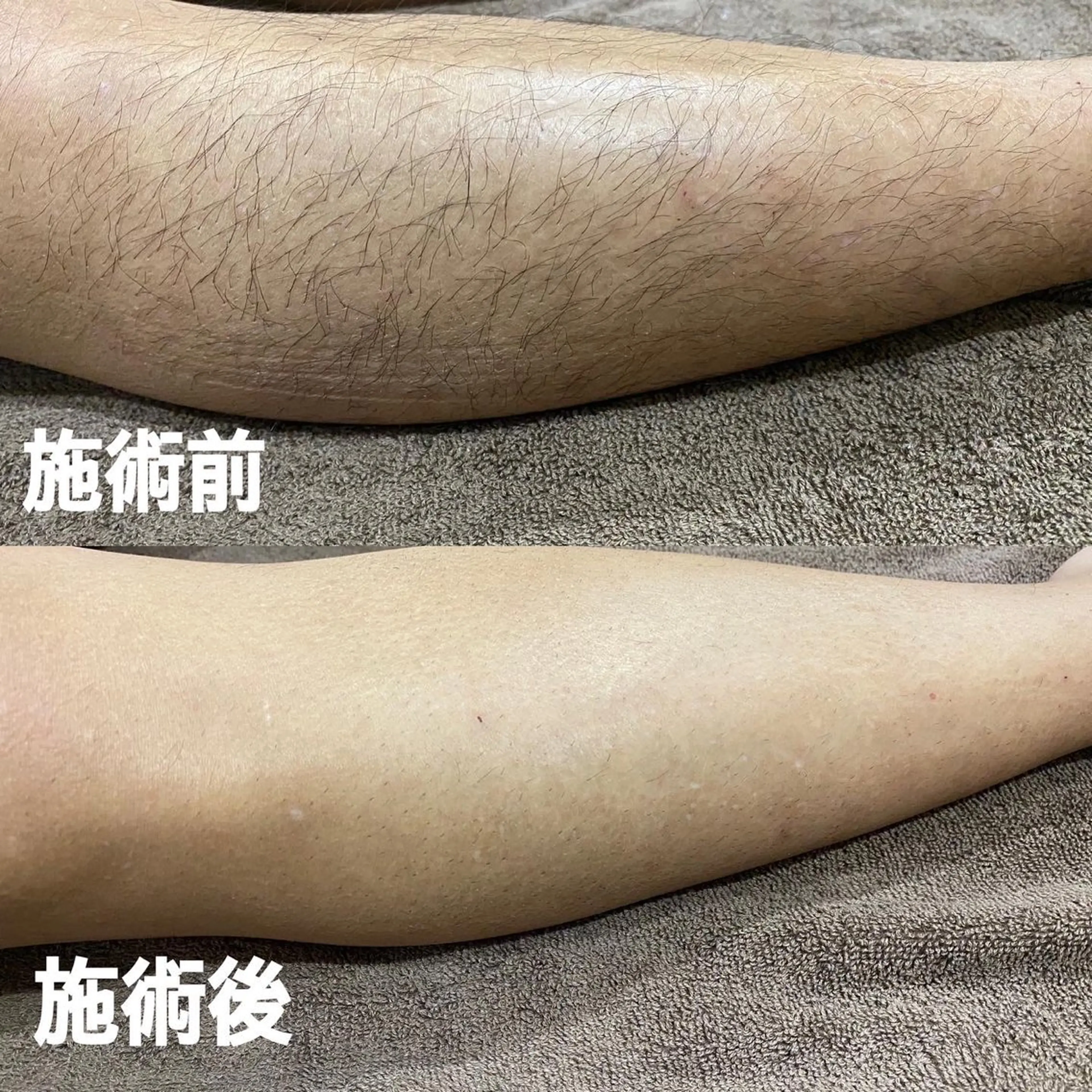 メンズ 脱毛 GALANTE beautysalon所属・泰中 郁未のエステ・リラクイメージ