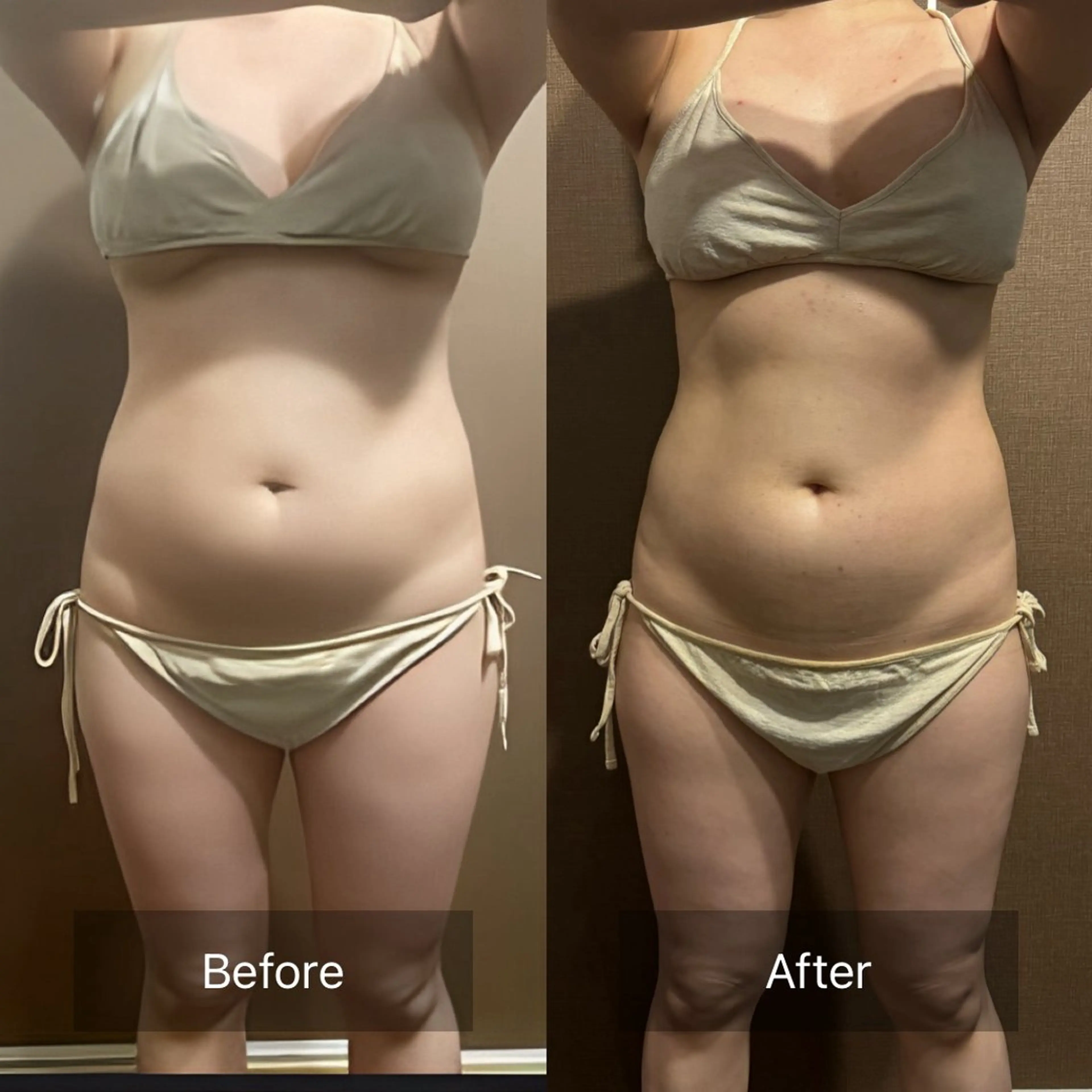 エステ 腸活/クビレを作る /痩身エステのエステ・リラクイメージ