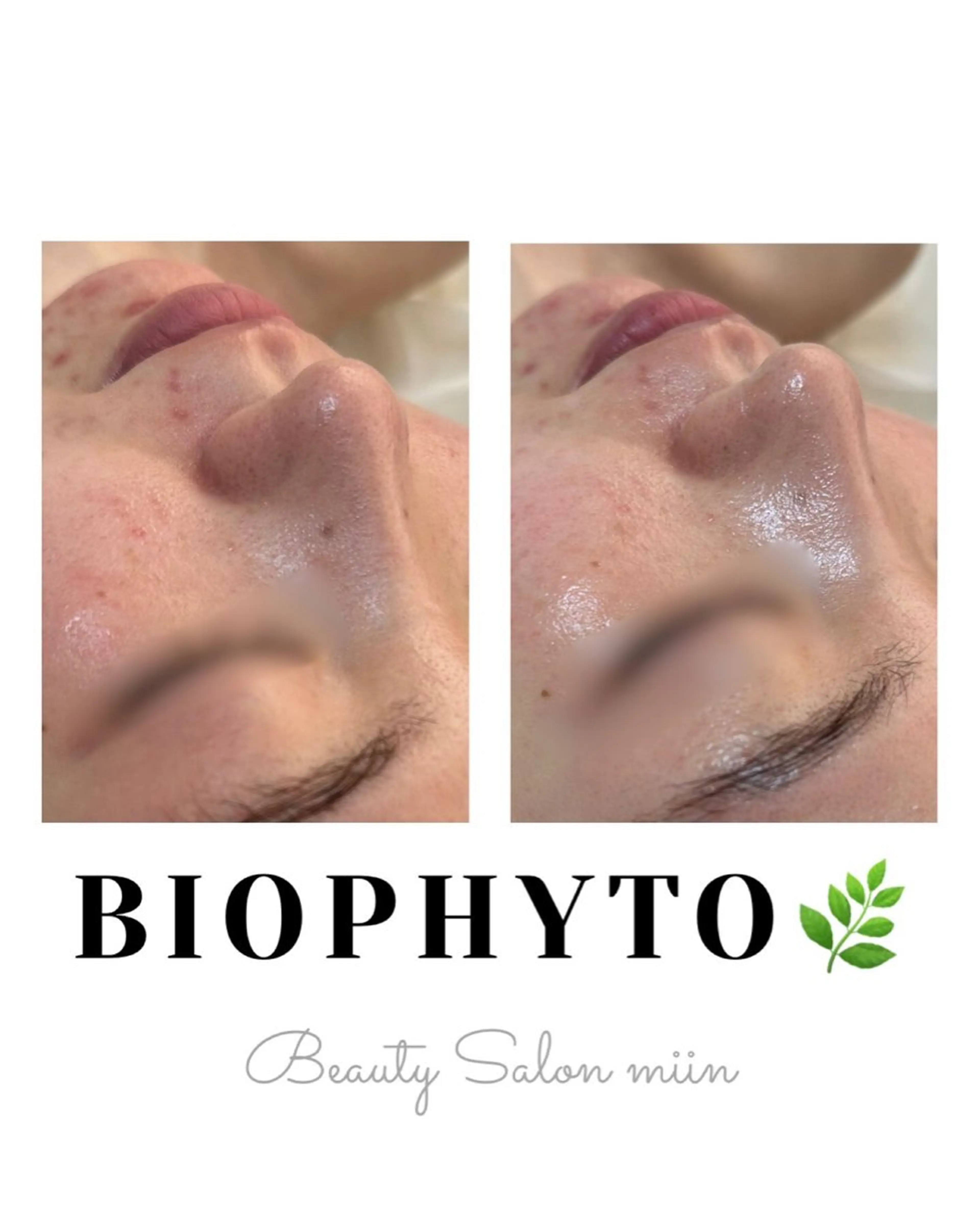 リラク 韓国肌管理 白玉肌管理®︎のエステ・リラクイメージ