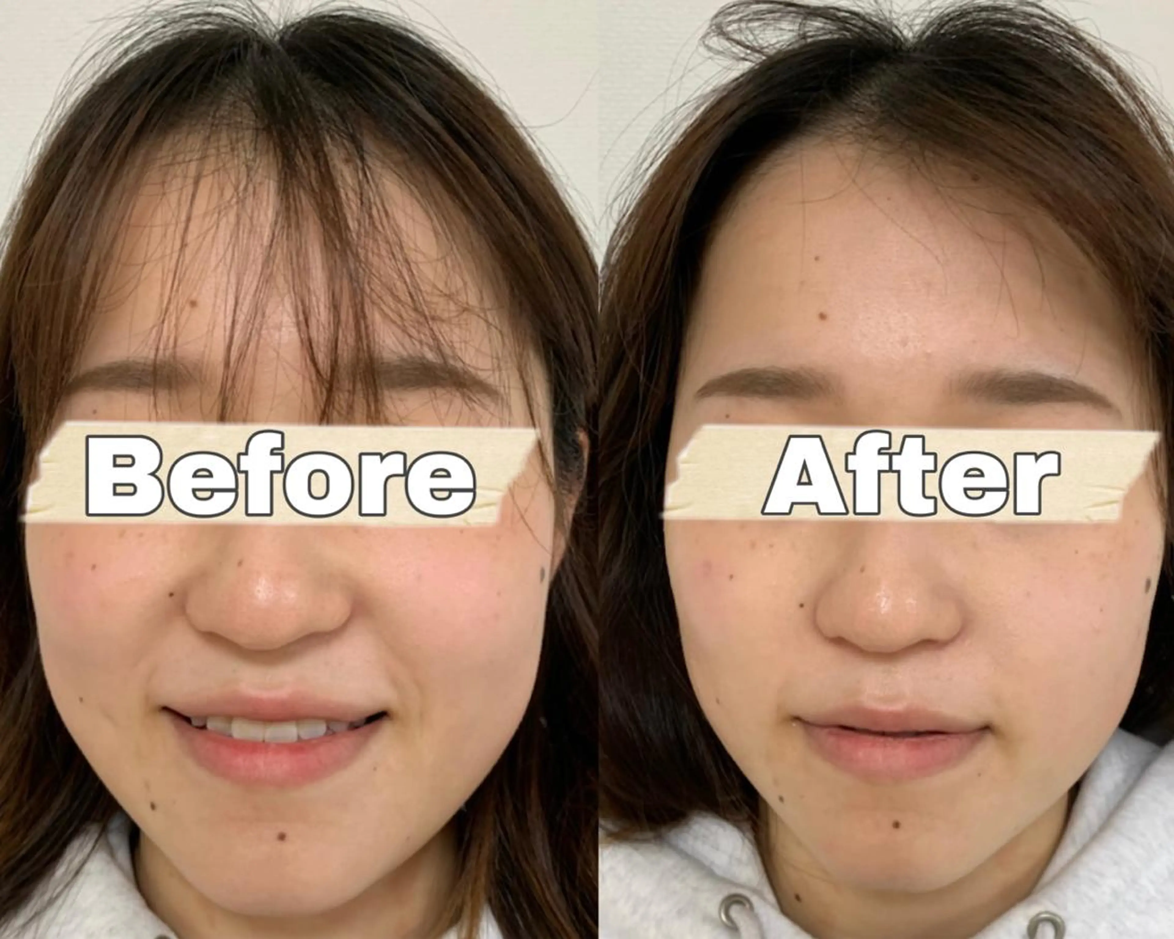 エステ 藤本 真心のネイルデザイン