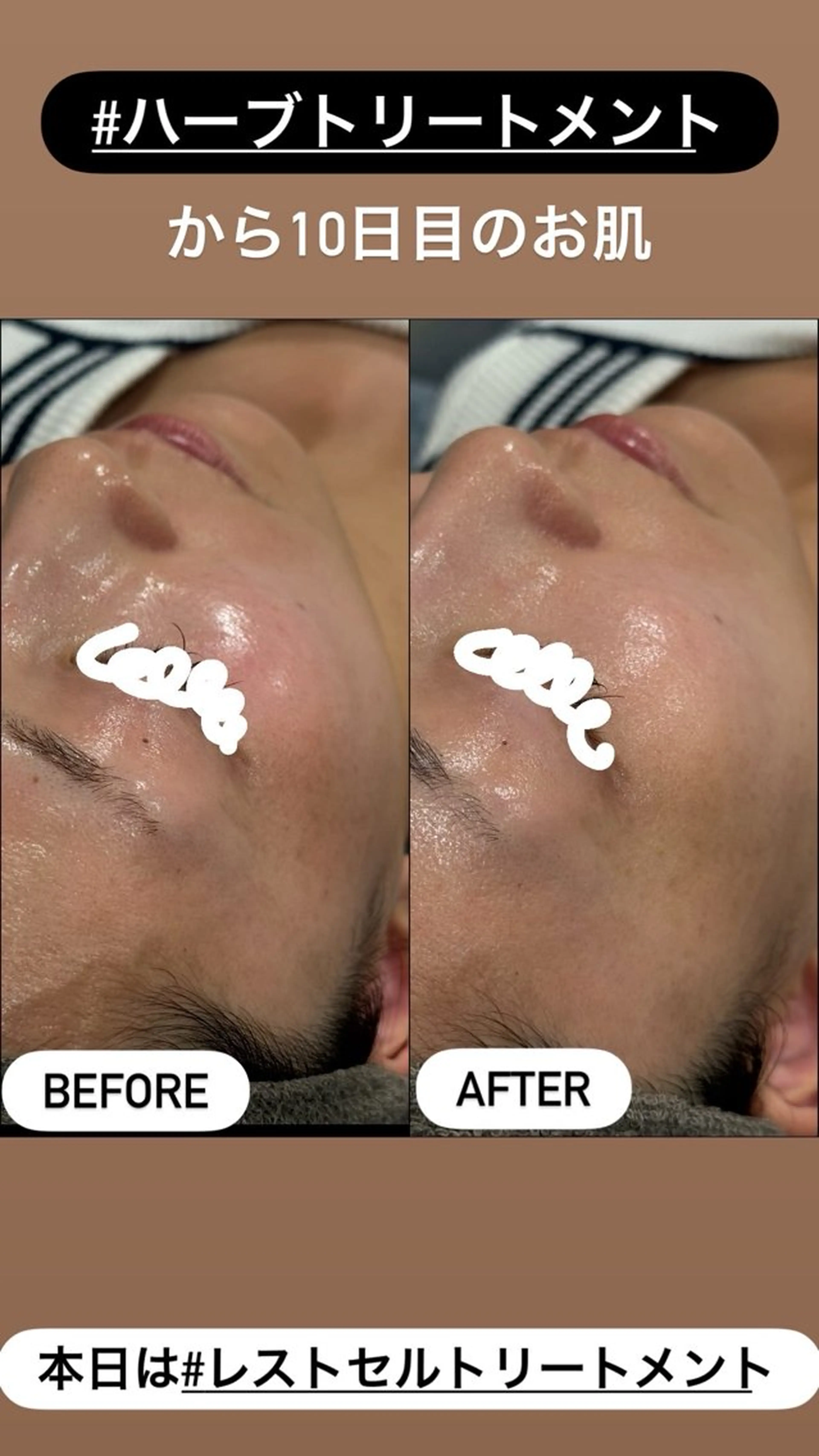 エステ LiZA エステティックサロンのエステ・リラクイメージ