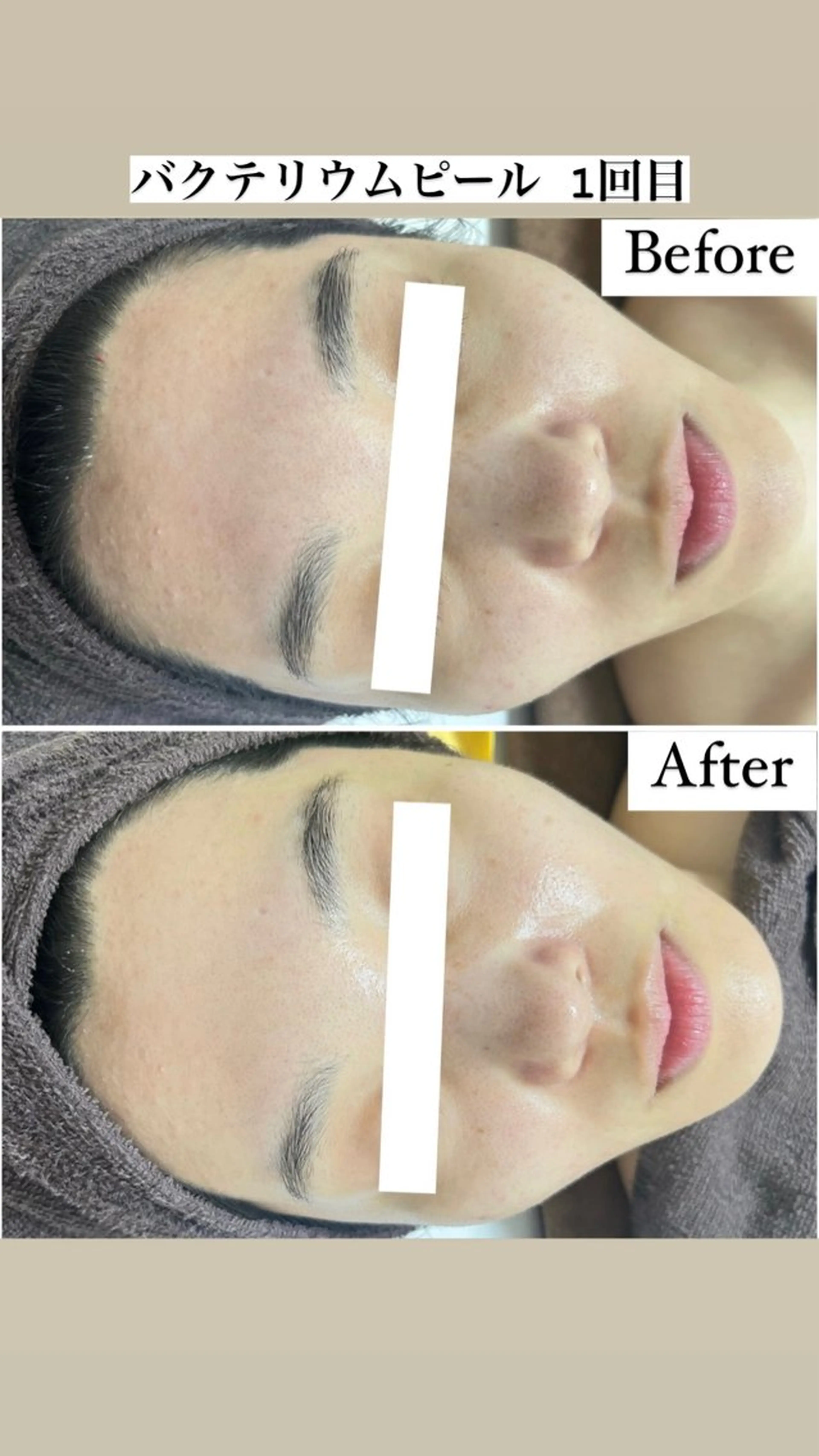 エステ Be Charm 山﨑のエステ・リラクイメージ