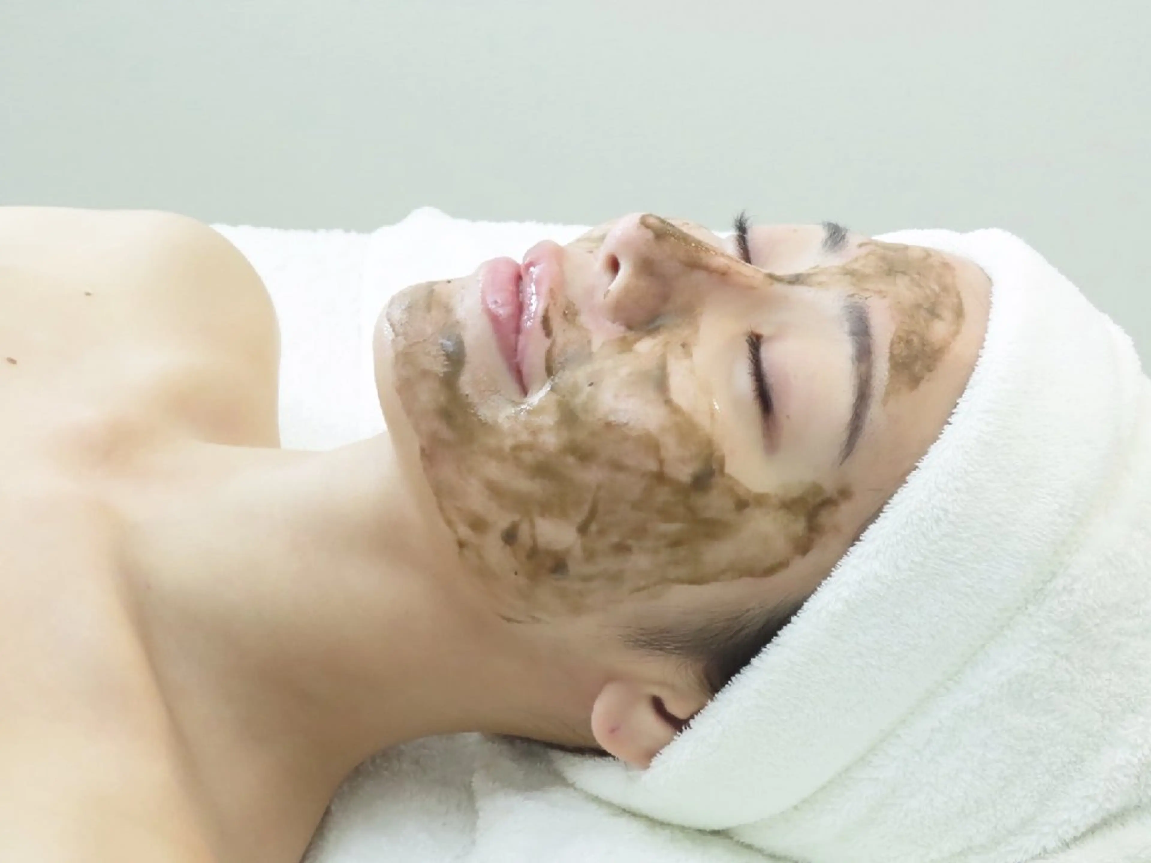 最新針入りハーブピーリング💆‍♀️剥離なしの写真