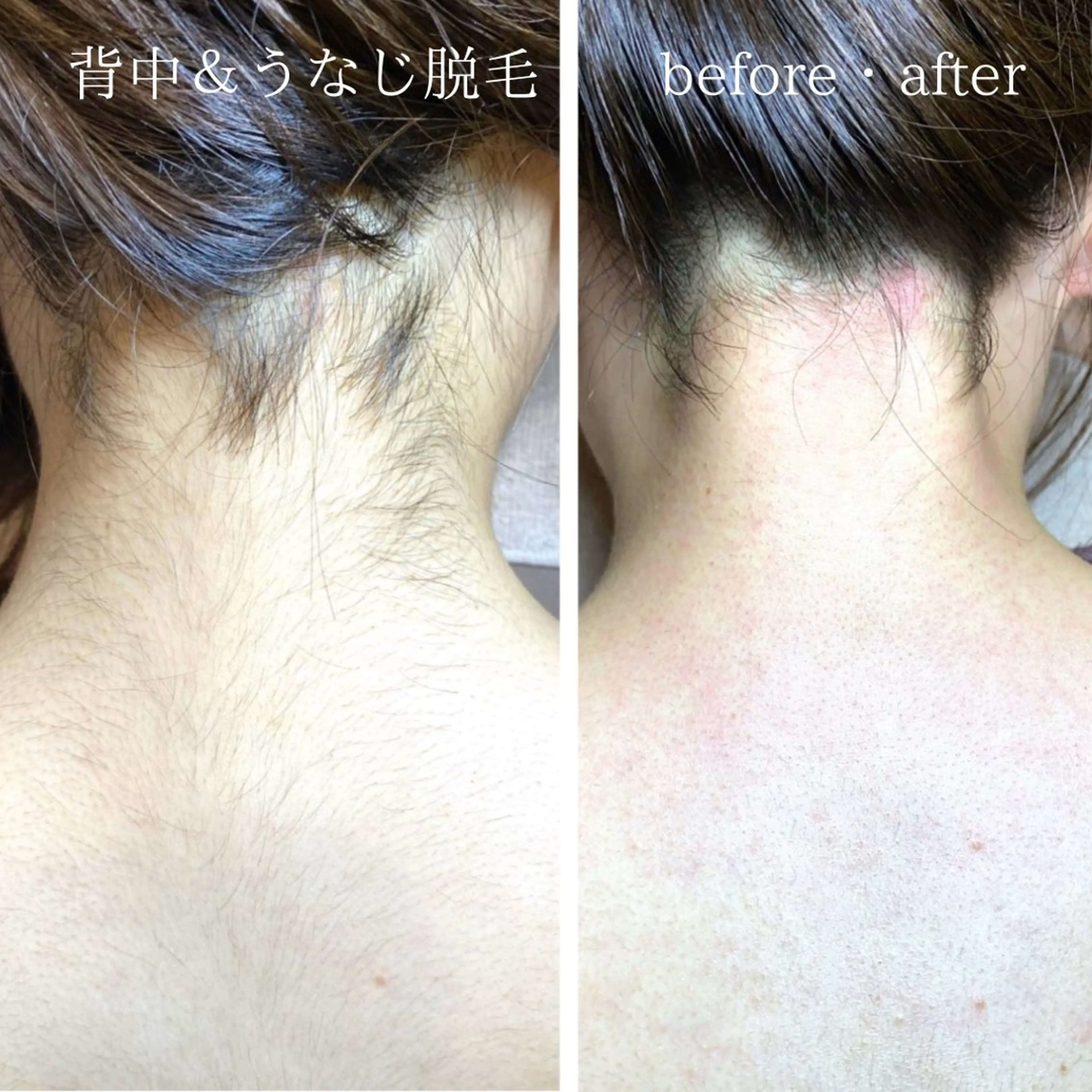 脱毛 An Blossom所属・An Blossom 脱毛/茅ヶ崎/美咲のエステ・リラクイメージ