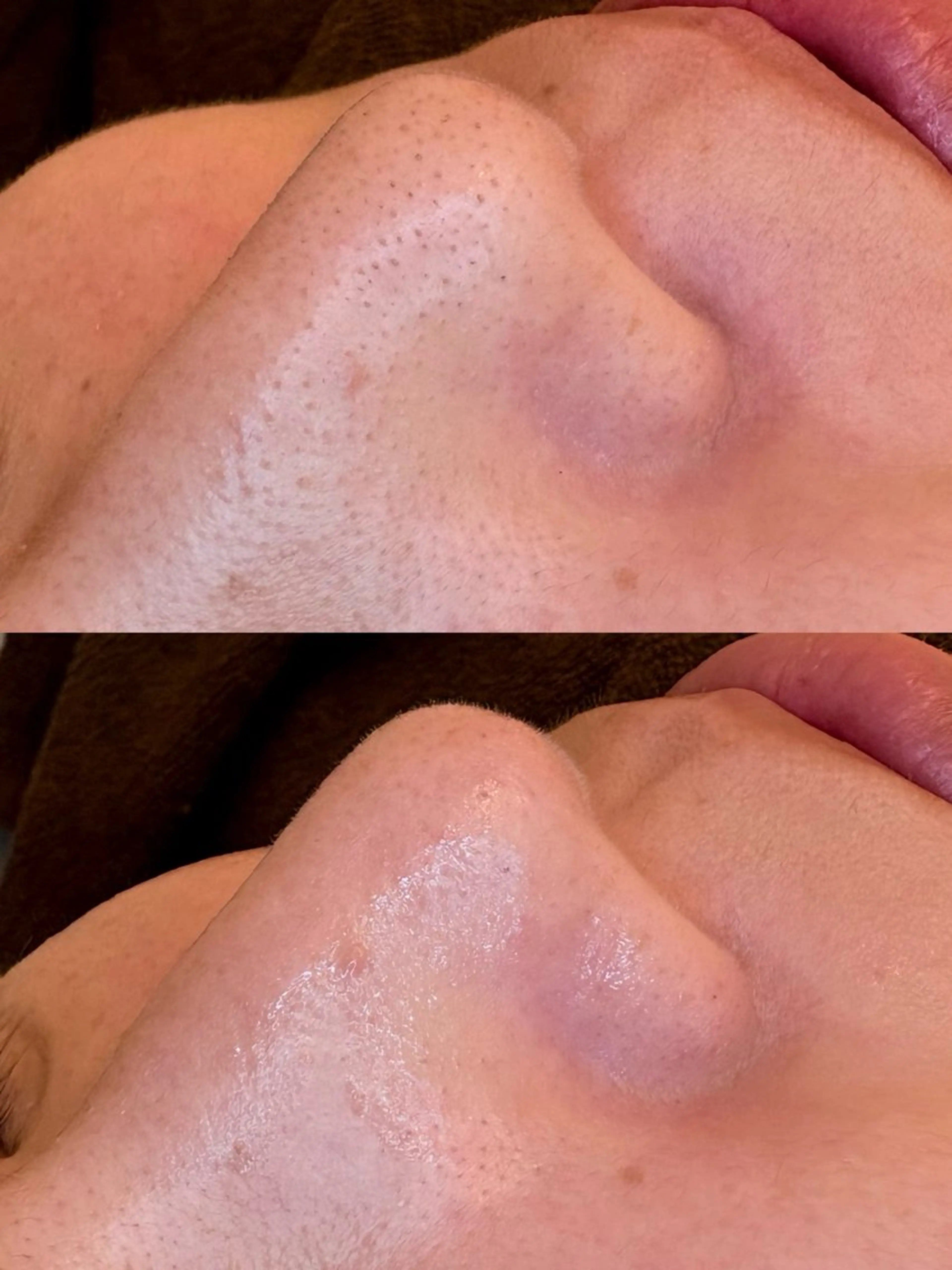 🤍アベシュリ /フェイシャル🤍のエステ・リラクイメージ