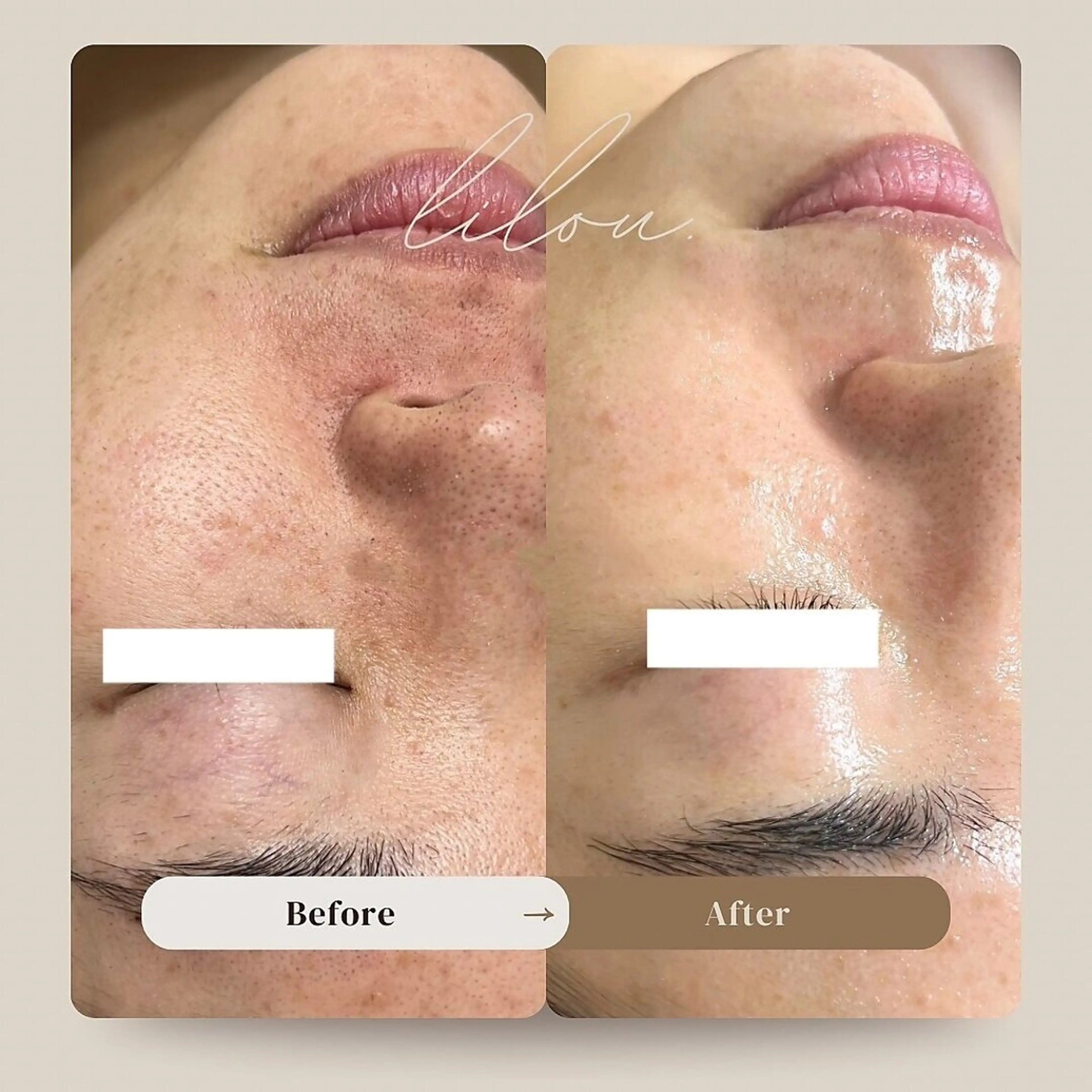 hue.所属・hue. YUKAのエステ・リラクイメージ