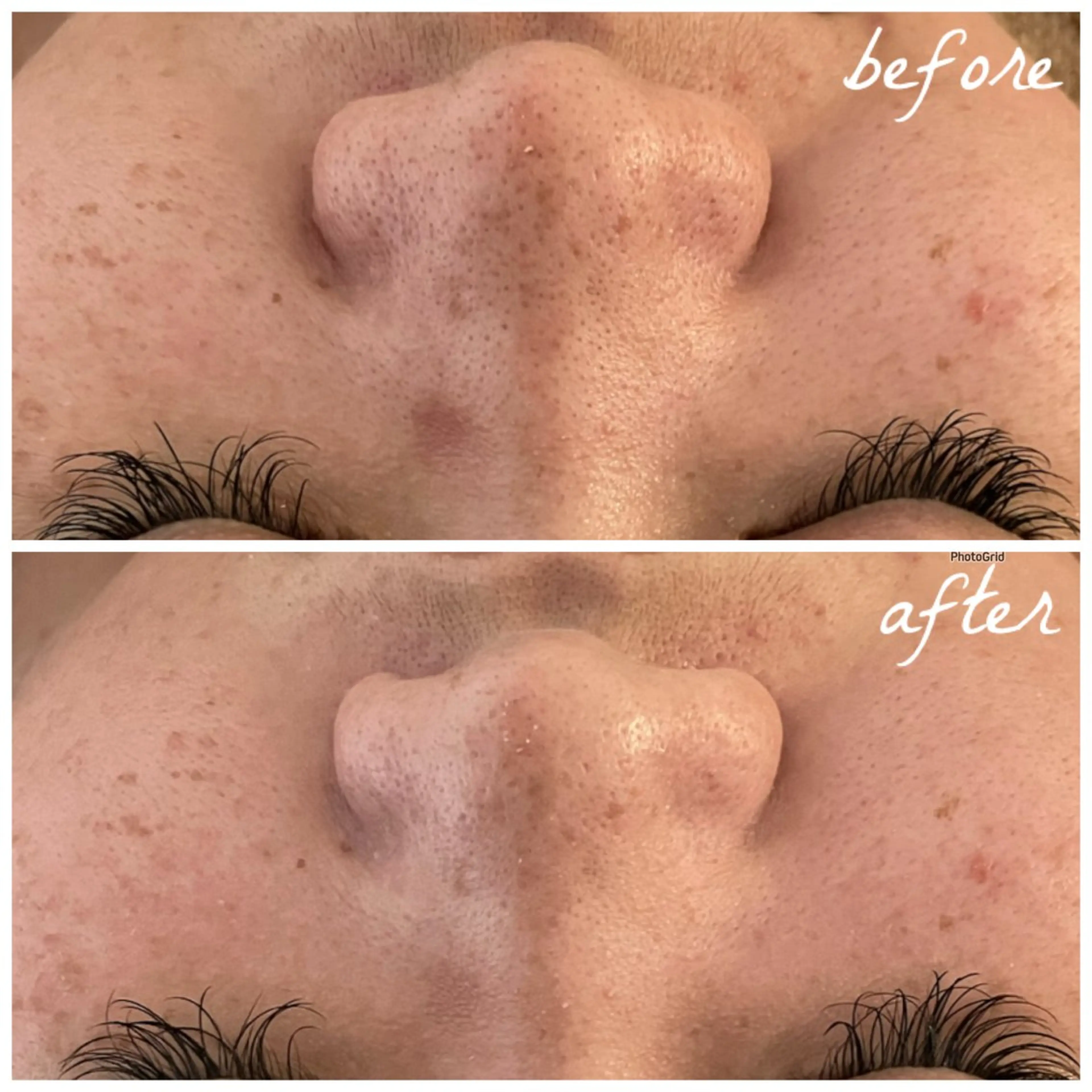 メンズ エステ メナード岐阜市茜部 杉浦のエステ・リラクイメージ