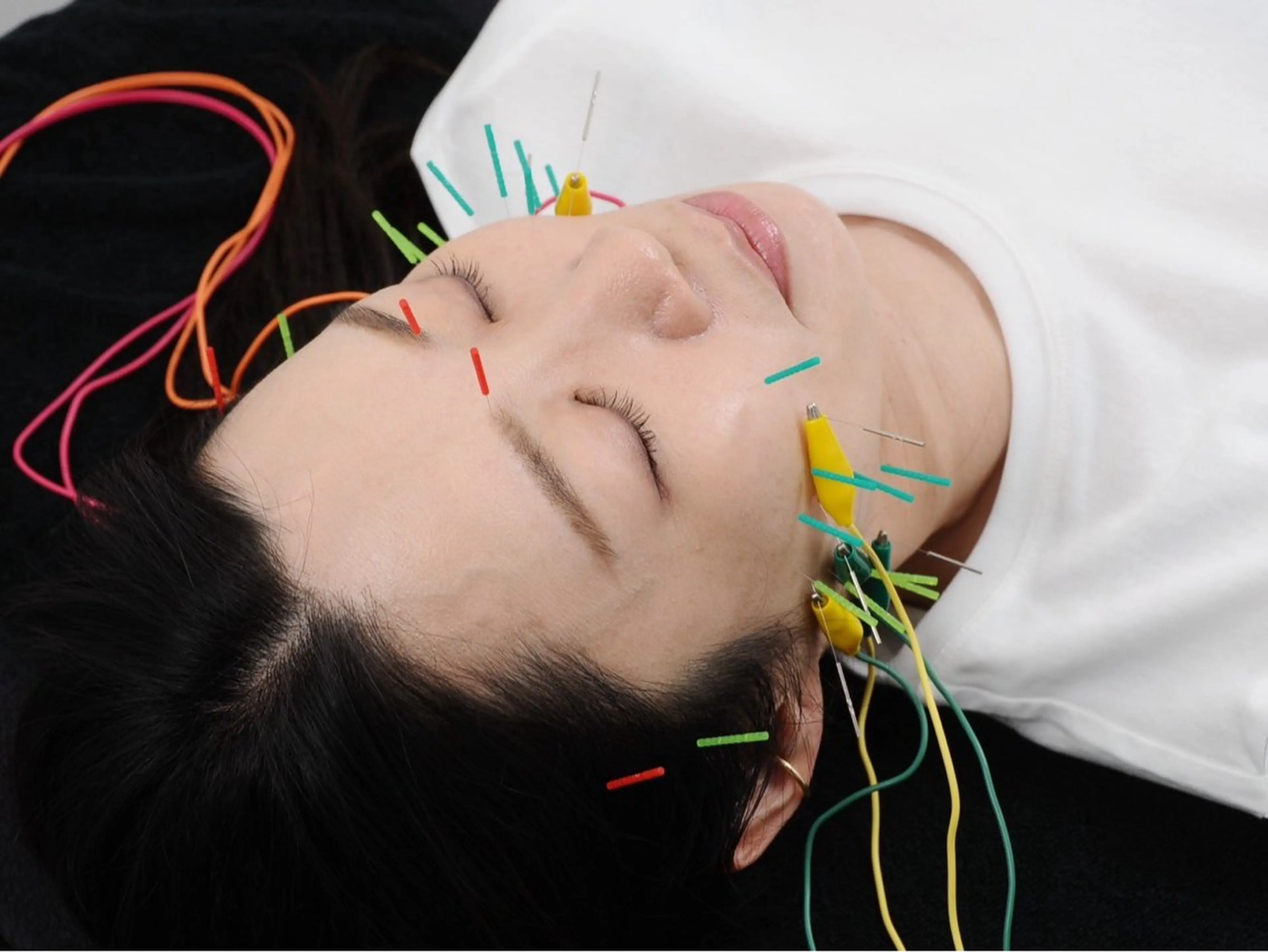 エステ リラク 小顔矯正・美容鍼 FLOW鍼灸整体院のエステ・リラクイメージ