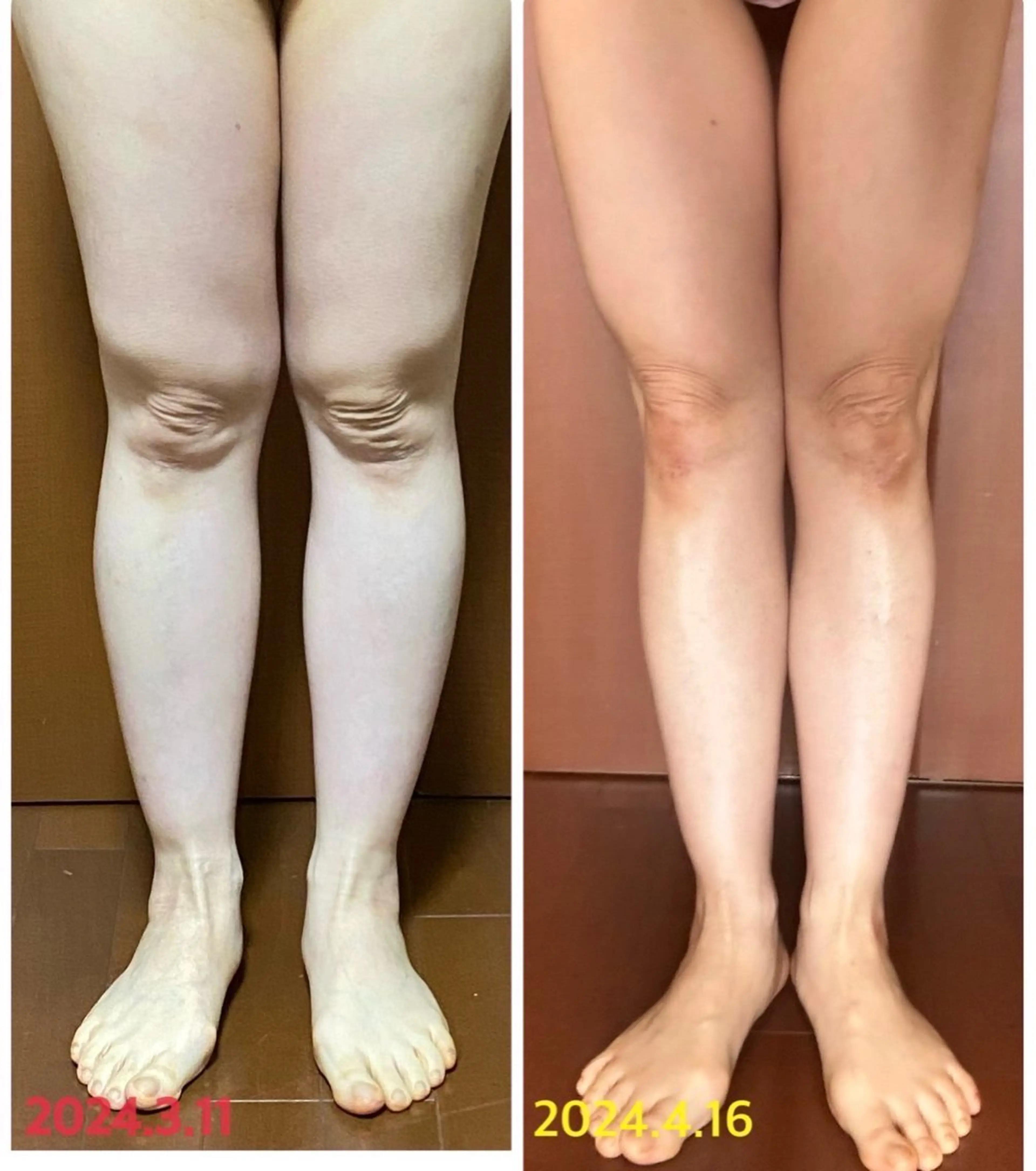 HISUI所属・IVY化粧品・ 勝山亜優奈のその他イメージ