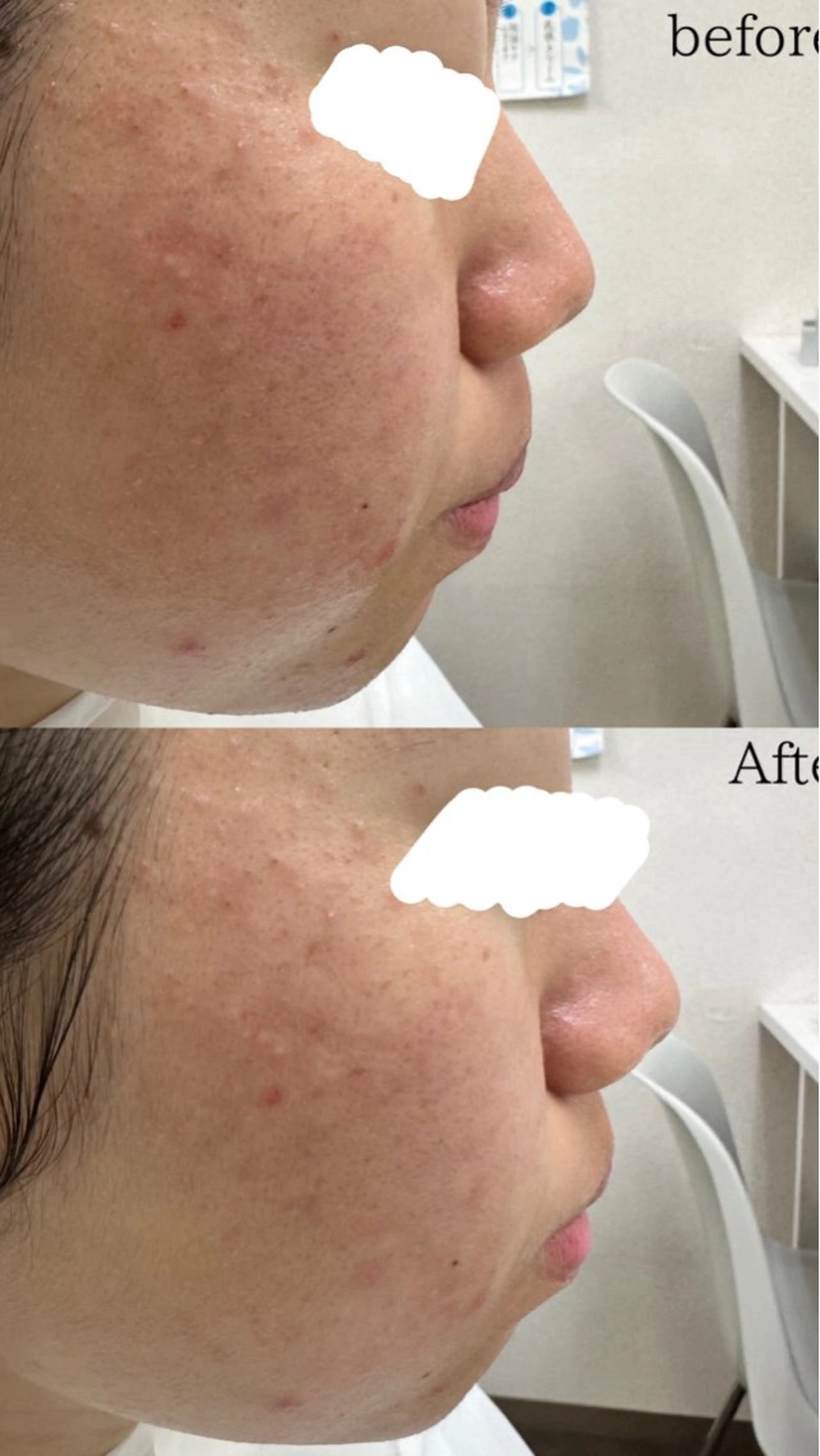 肌質/体質改善 久下玲菜のエステ・リラクイメージ