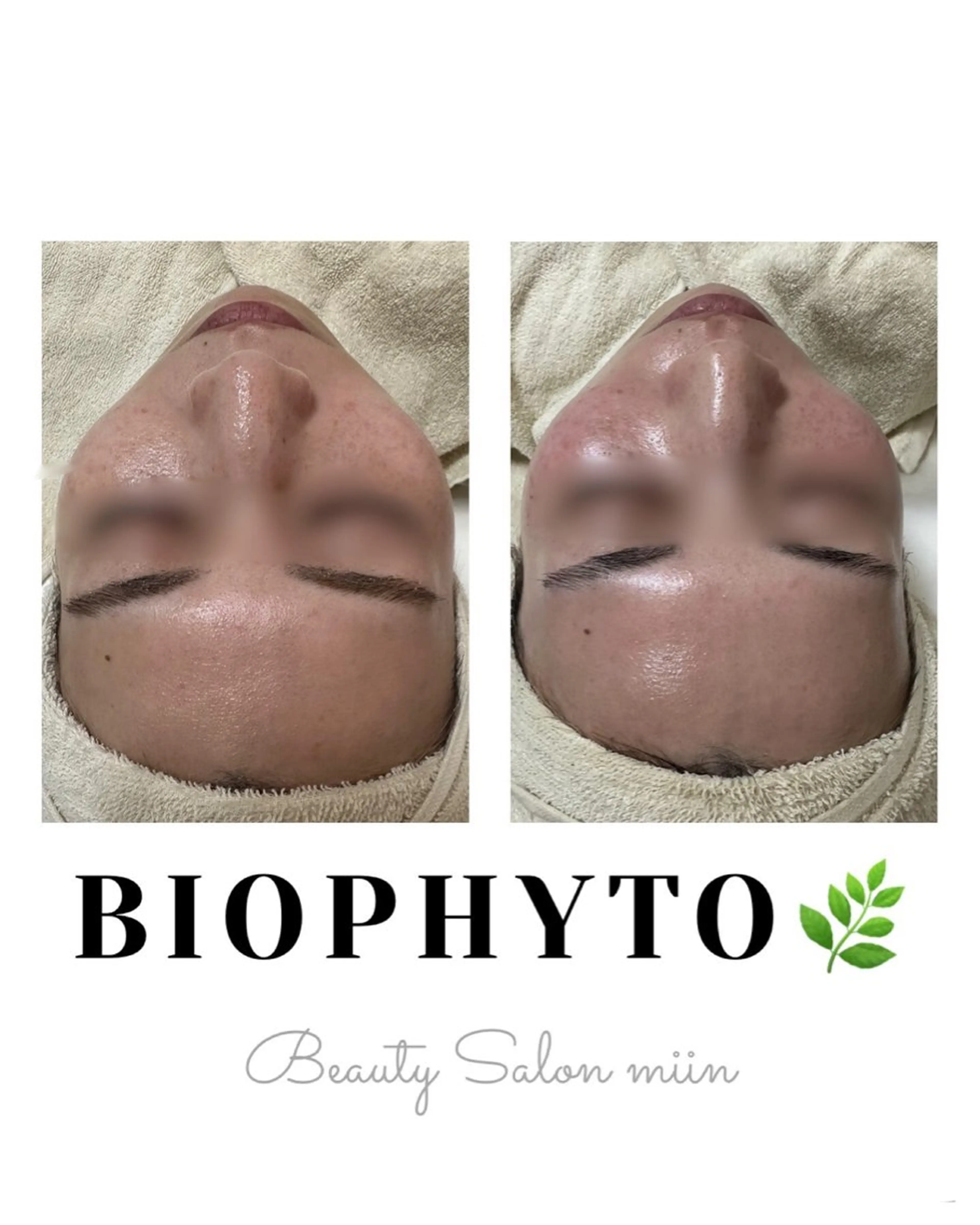 エステ 韓国肌管理 白玉肌管理®︎のエステ・リラクイメージ