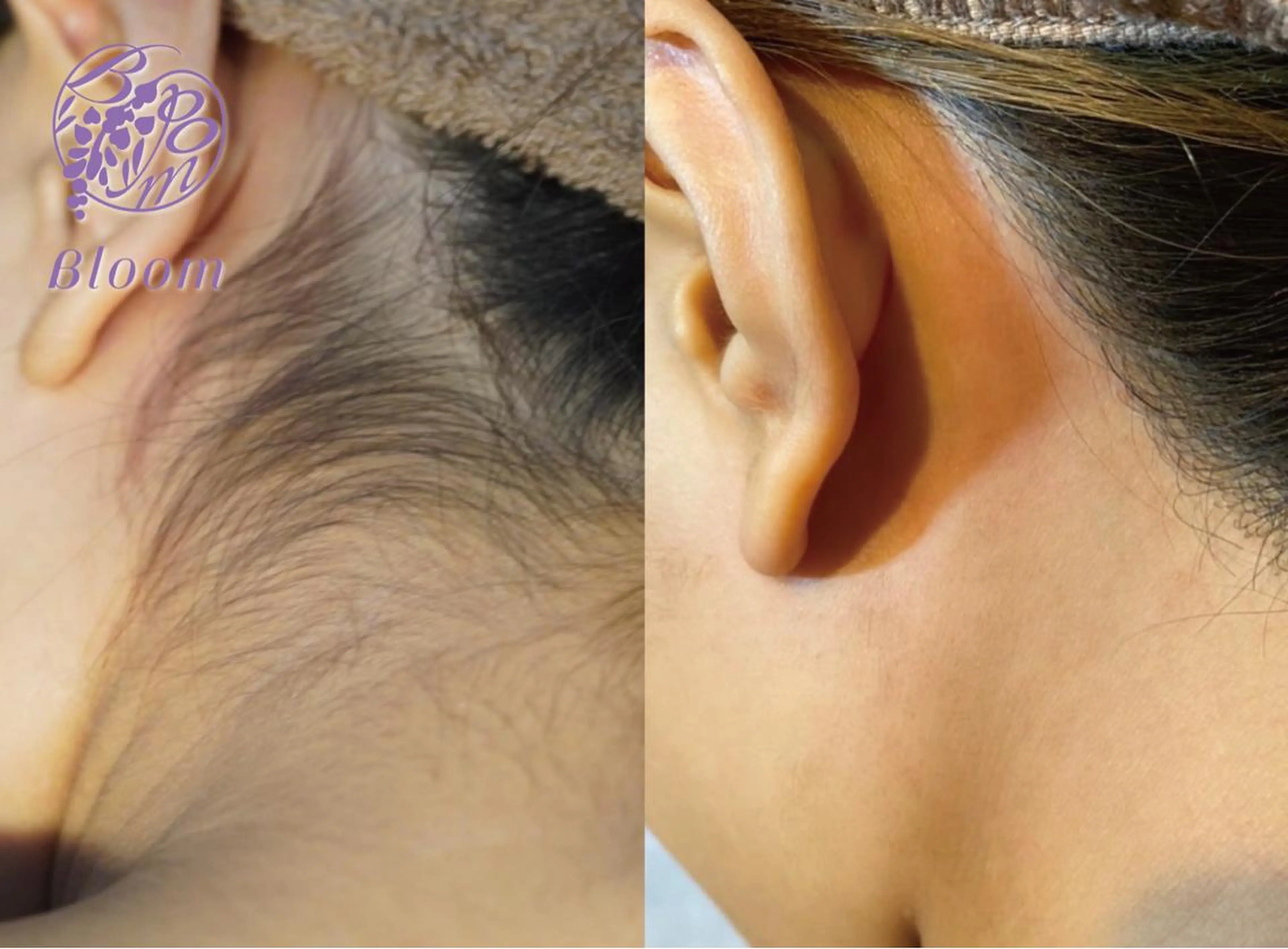 池袋脱毛 さとうのエステ・リラクイメージ